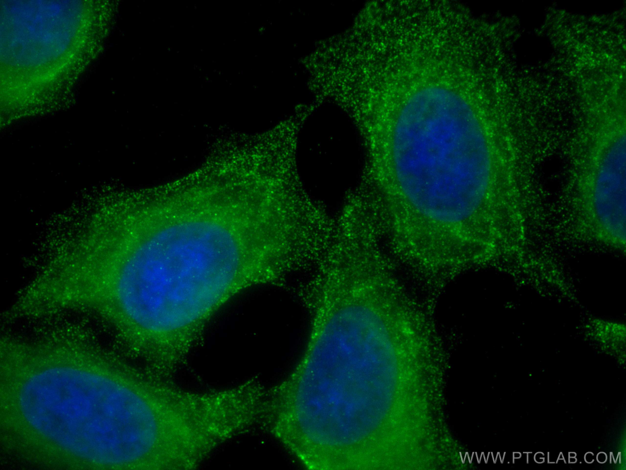 Immunofluorescence (IF) / fluorescent staining of MCF-7 cells using ASAH1 Monoclonal antibody (67092-2-Ig)