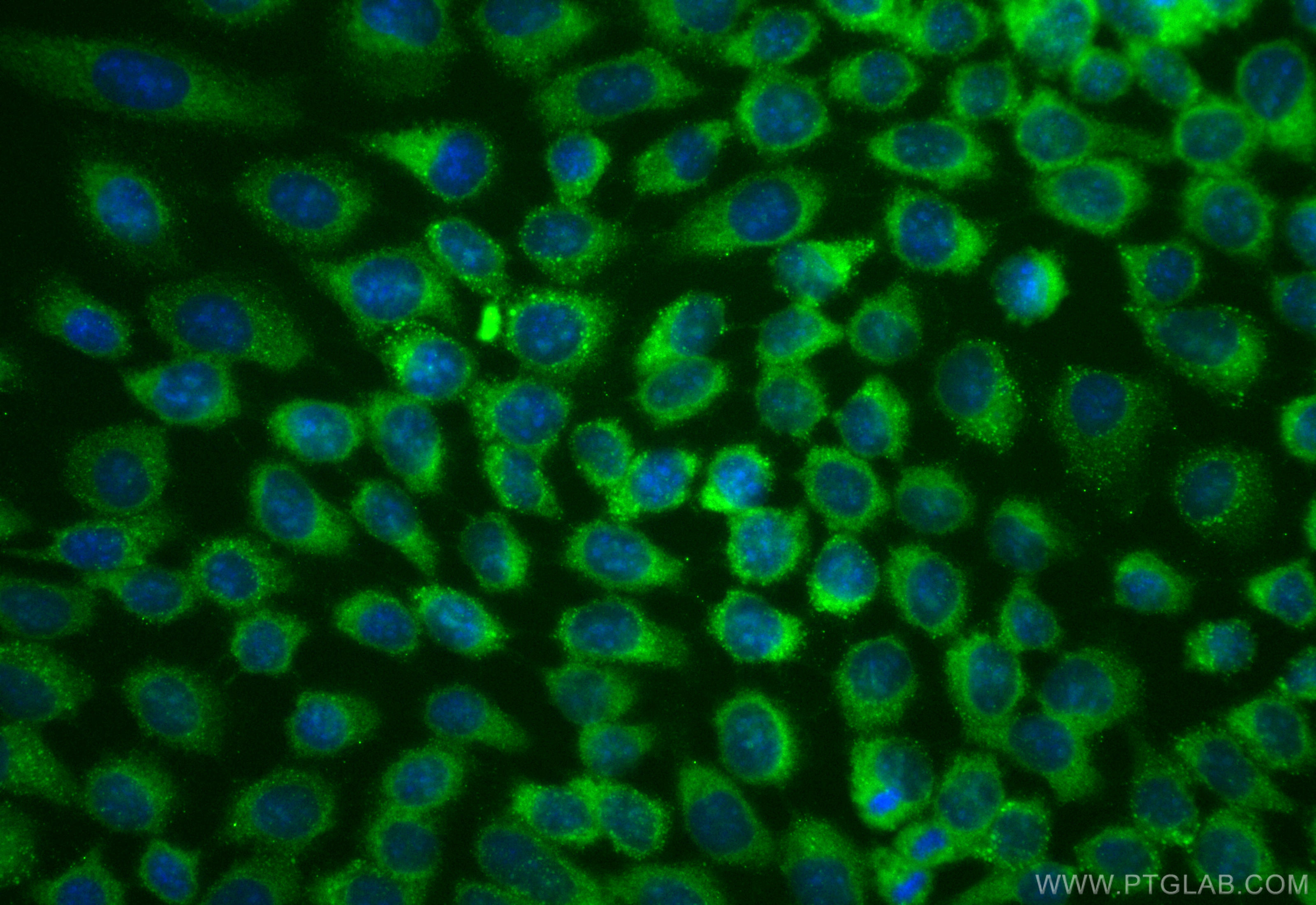 Immunofluorescence (IF) / fluorescent staining of A431 cells using CoraLite® Plus 488-conjugated ASCC3 Recombinant mo (CL488-85130-2)