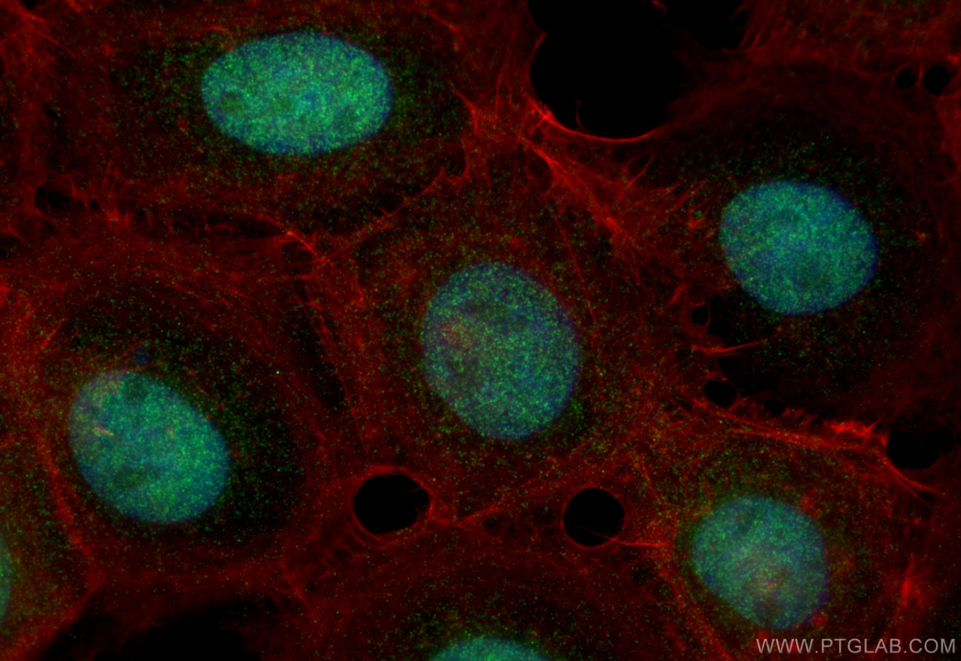 Immunofluorescence (IF) / fluorescent staining of A431 cells using ASF1A-specific Polyclonal antibody (22259-1-AP)