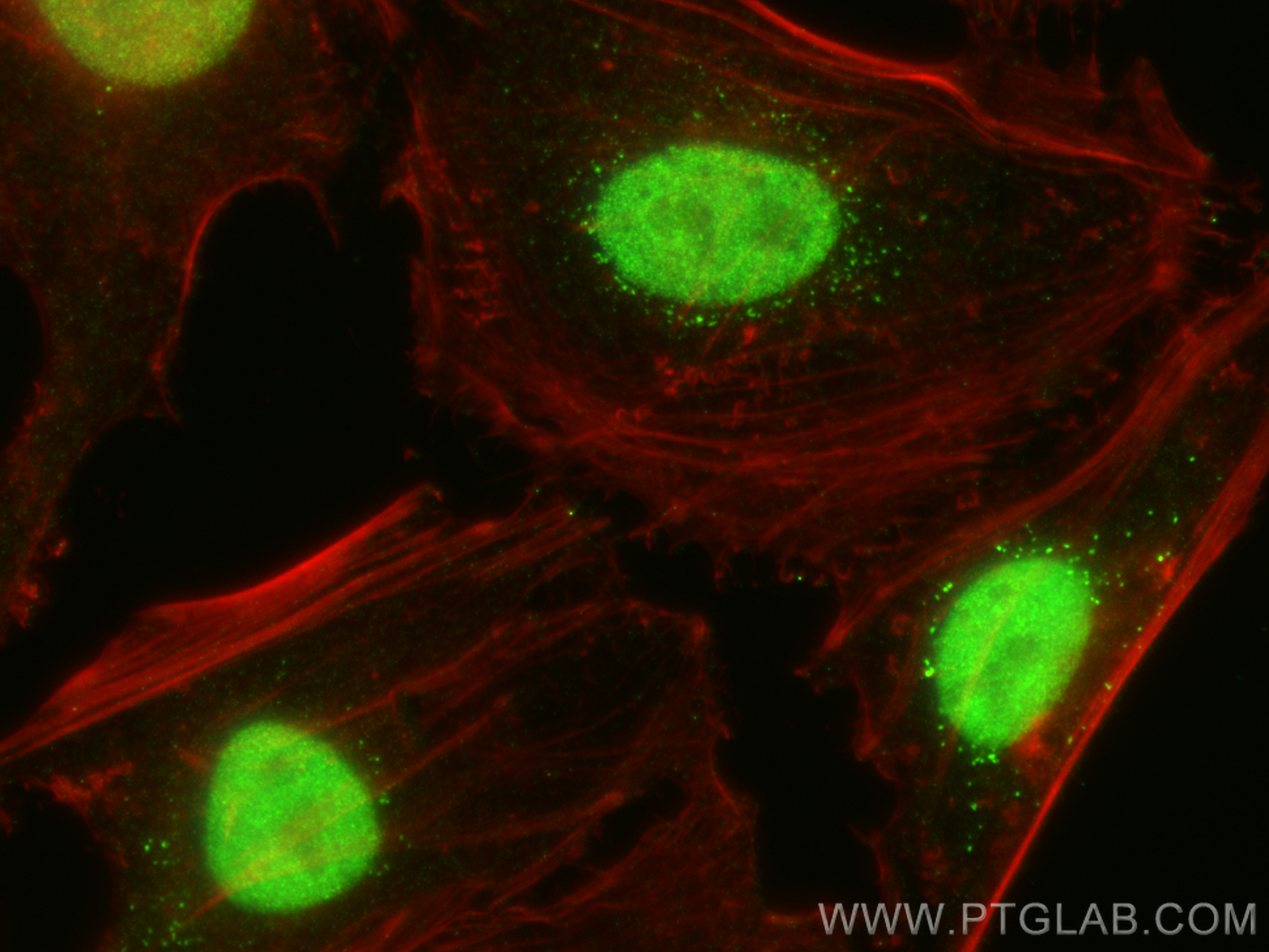 Immunofluorescence (IF) / fluorescent staining of HeLa cells using ASF1B-specific Polyclonal antibody (22258-1-AP)