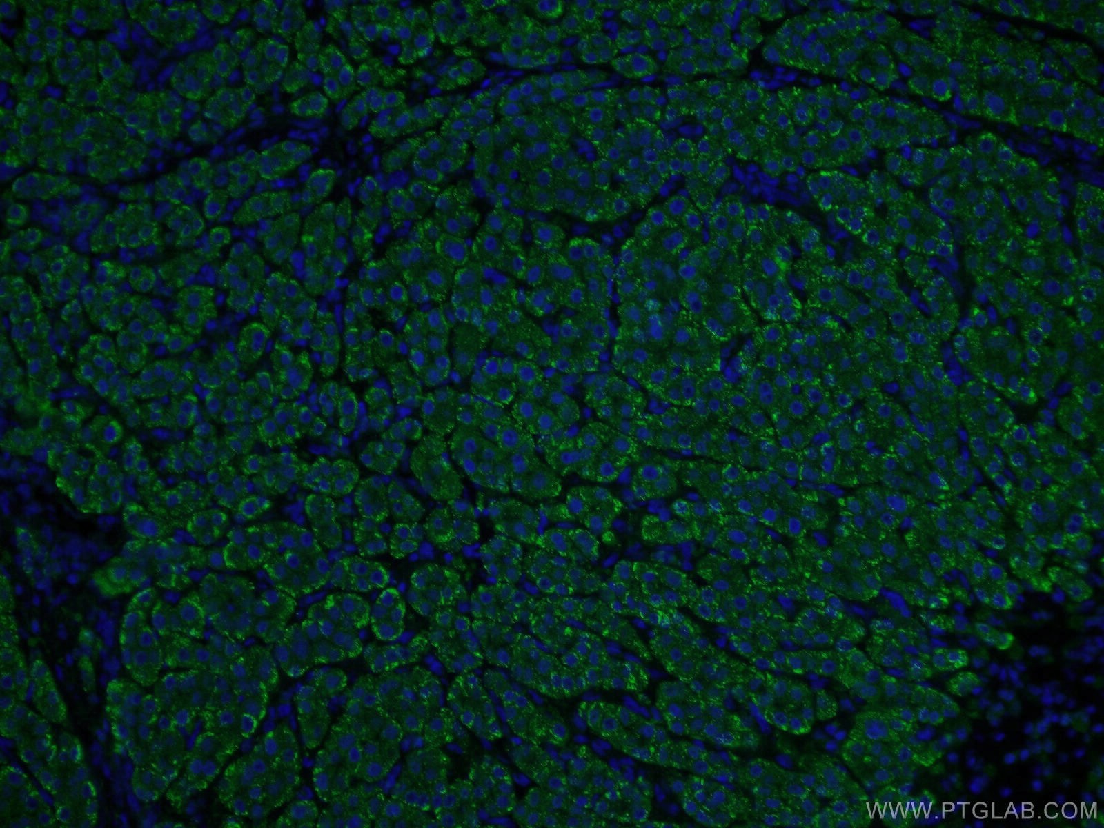 ASGR1 Antibody (11739-1-AP) | Proteintech