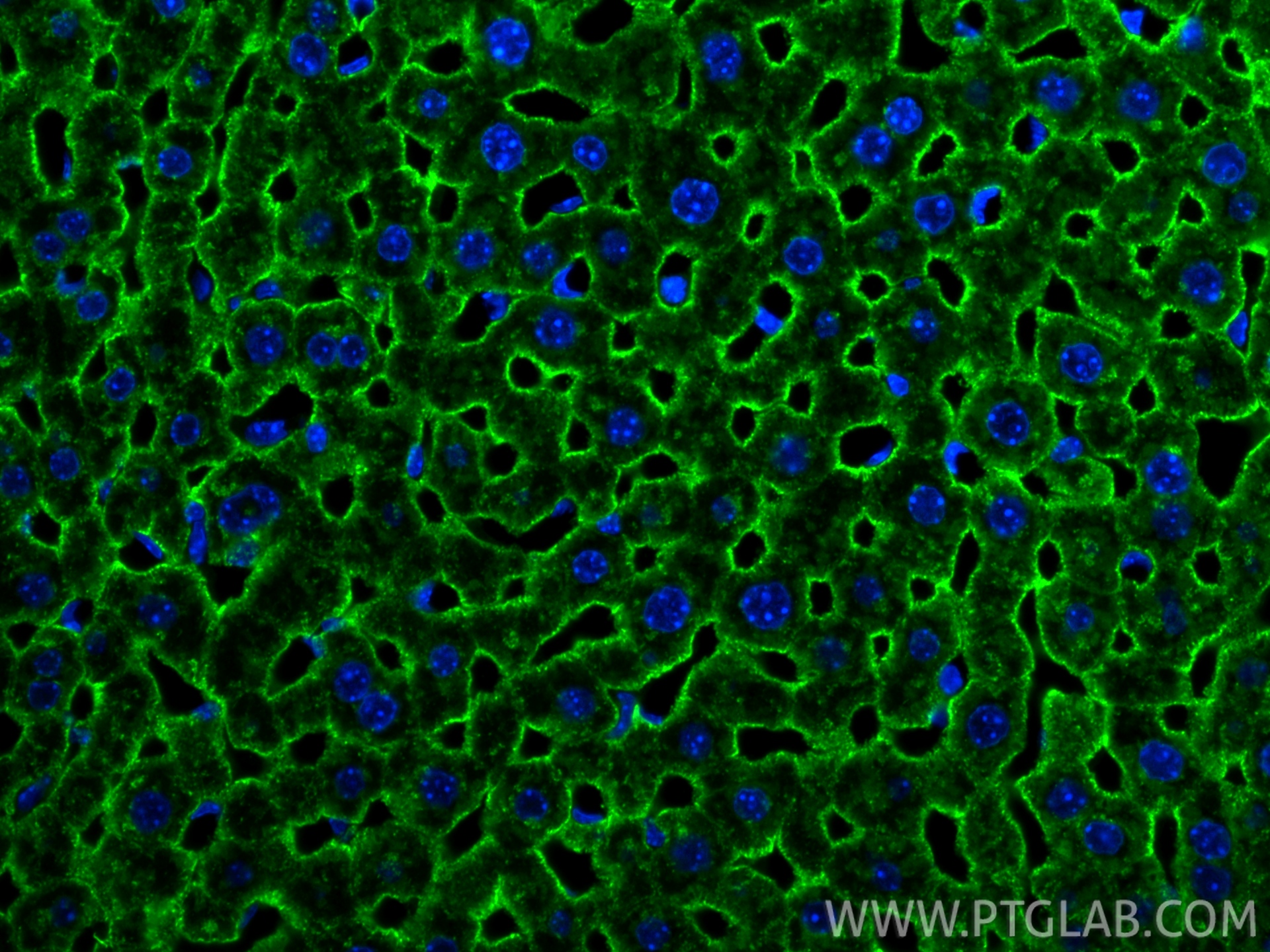 Immunofluorescence (IF) / fluorescent staining of mouse liver tissue using ASGR1 Polyclonal antibody (11739-1-AP)
