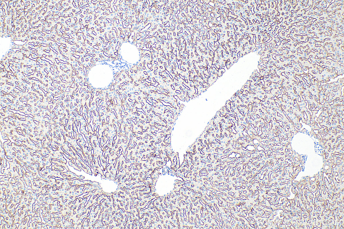 Immunohistochemistry (IHC) staining of rat liver tissue using ASGR1 Polyclonal antibody (11739-1-AP)