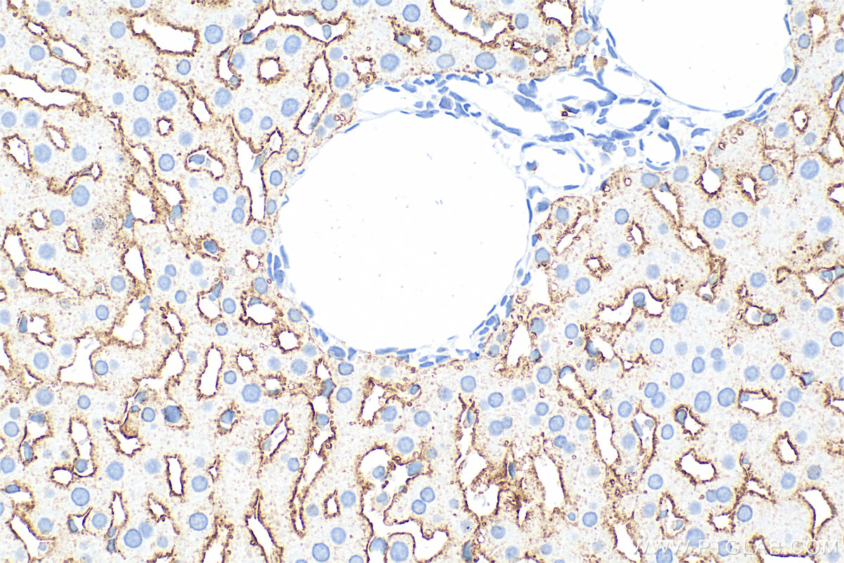 Immunohistochemistry (IHC) staining of rat liver tissue using ASGR1 Polyclonal antibody (11739-1-AP)