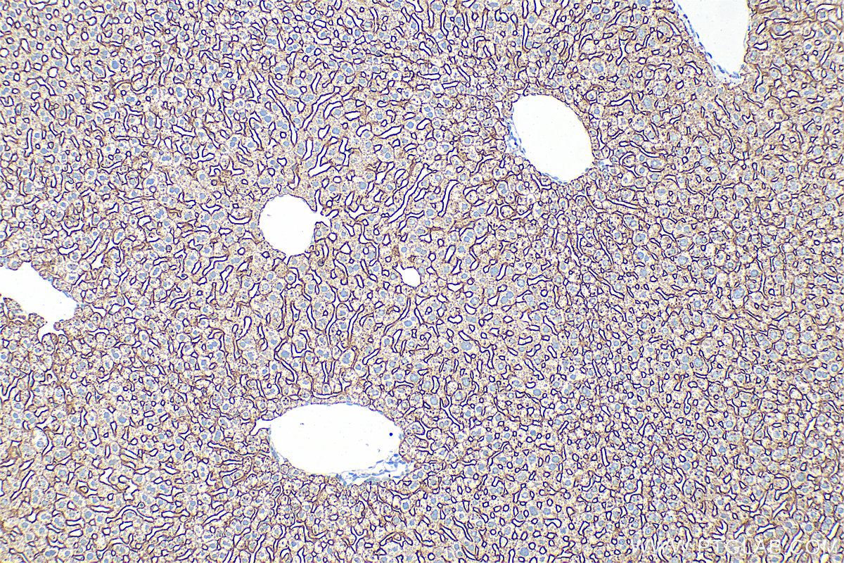 Immunohistochemistry (IHC) staining of mouse liver tissue using ASGR1 Polyclonal antibody (11739-1-AP)