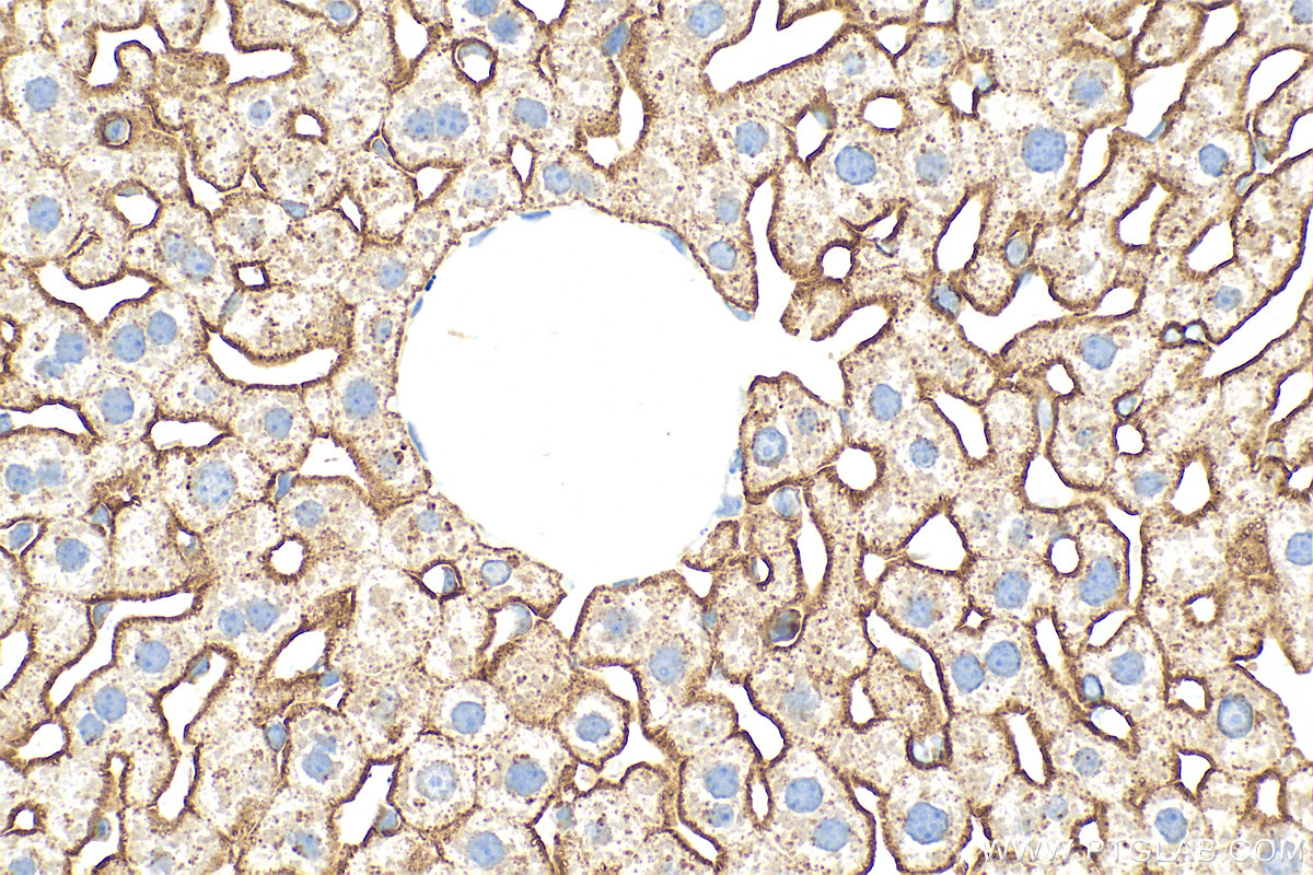 Immunohistochemistry (IHC) staining of mouse liver tissue using ASGR1 Polyclonal antibody (11739-1-AP)