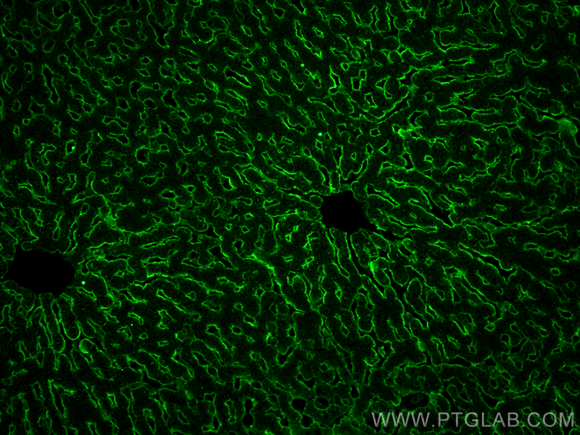 Immunofluorescence (IF) / fluorescent staining of rat liver tissue using ASGR1 Polyclonal antibody (31338-1-AP)