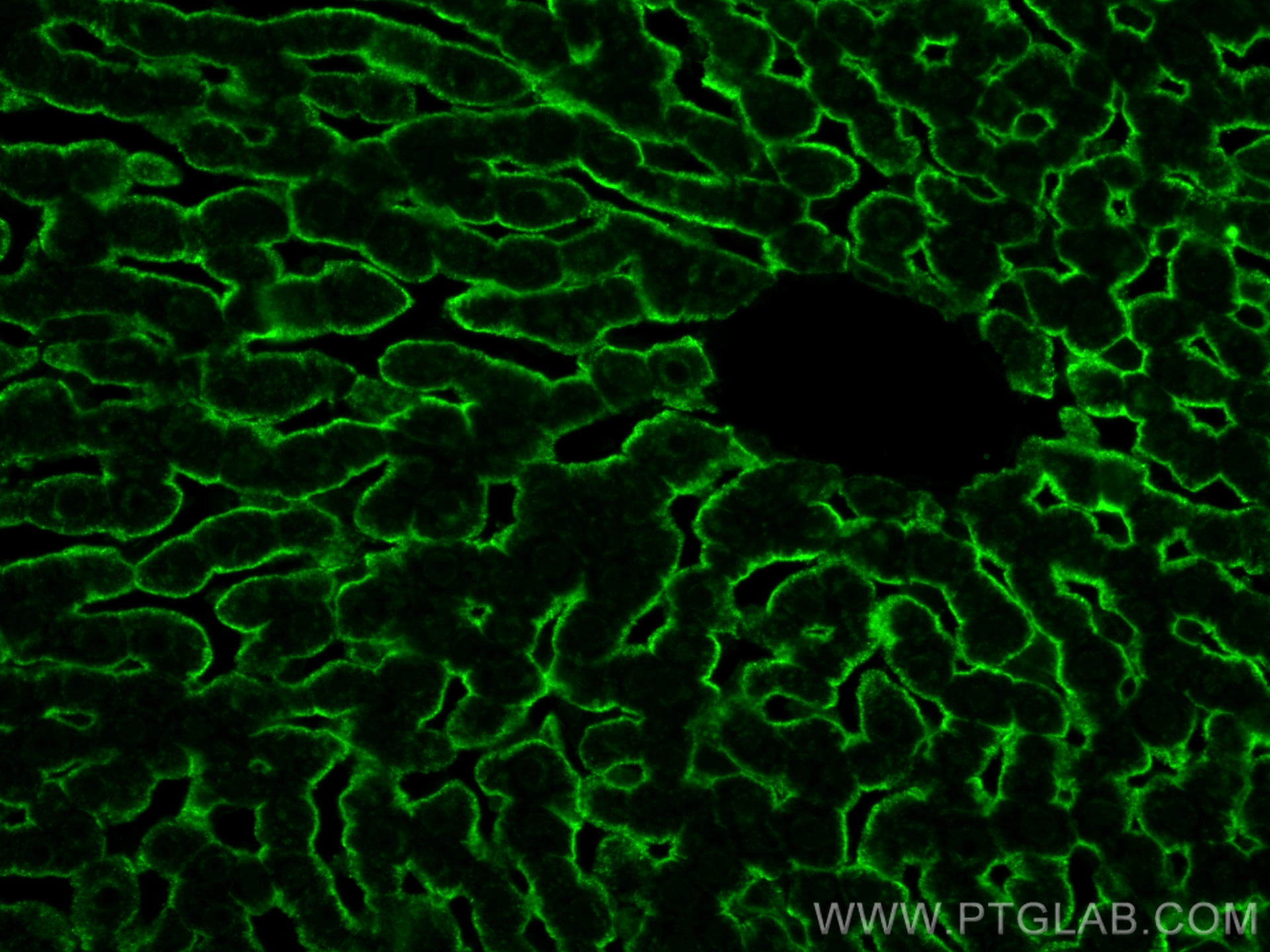 Immunofluorescence (IF) / fluorescent staining of rat liver tissue using ASGR1 Polyclonal antibody (31338-1-AP)