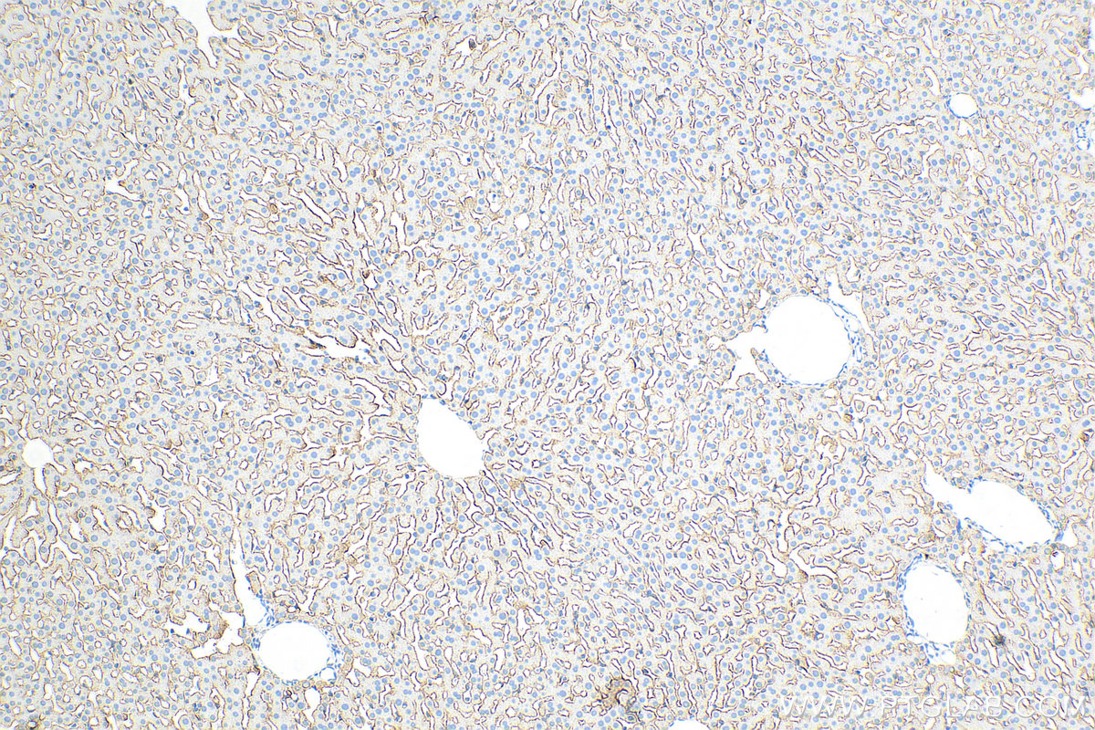 Immunohistochemistry (IHC) staining of rat liver tissue using ASGR1 Polyclonal antibody (31338-1-AP)