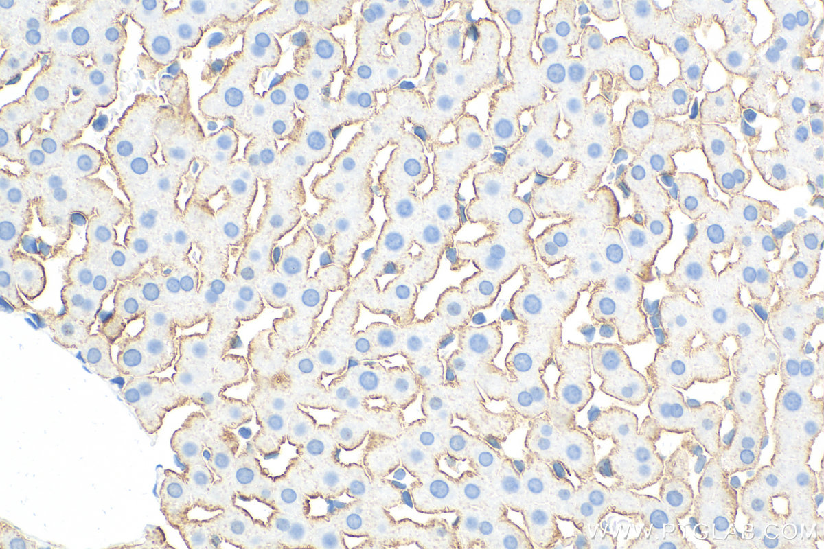 Immunohistochemistry (IHC) staining of rat liver tissue using ASGR1 Polyclonal antibody (31338-1-AP)