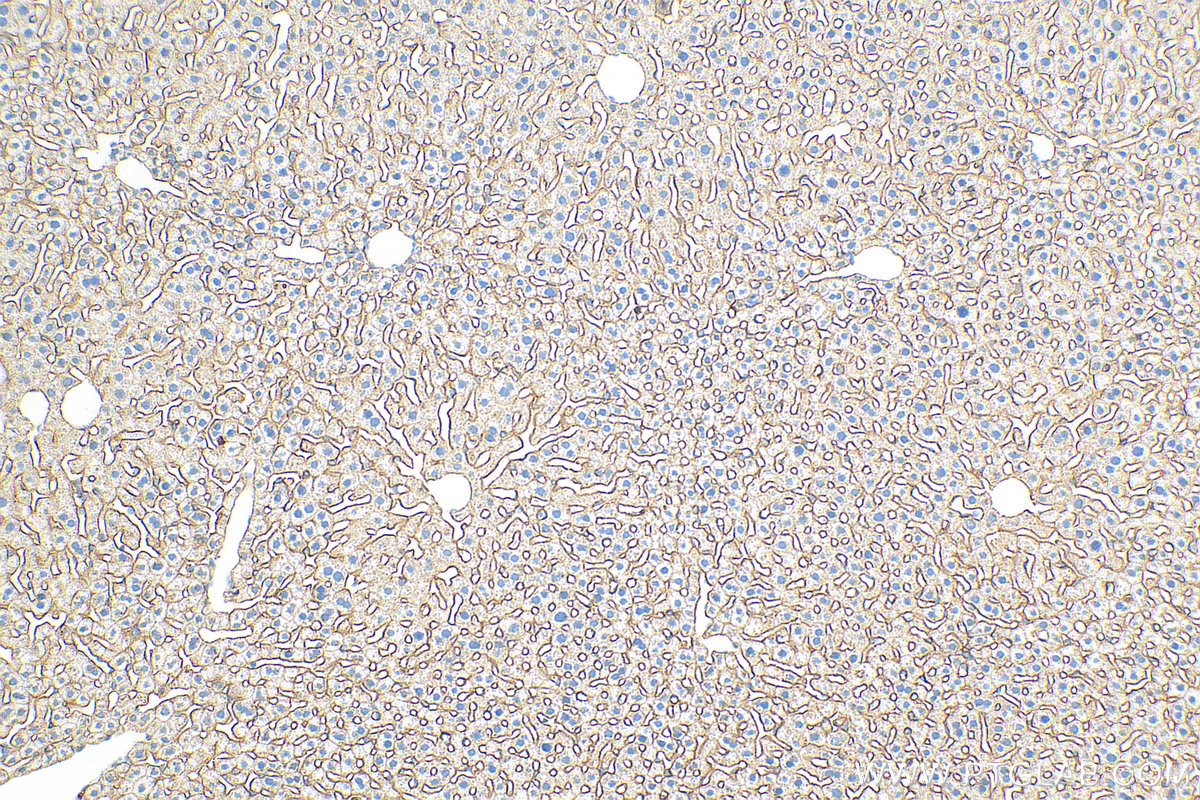 Immunohistochemistry (IHC) staining of mouse liver tissue using ASGR1 Polyclonal antibody (31338-1-AP)