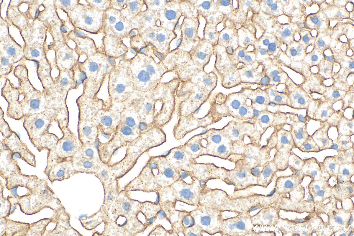 Immunohistochemistry (IHC) staining of mouse liver tissue using ASGR1 Polyclonal antibody (31338-1-AP)