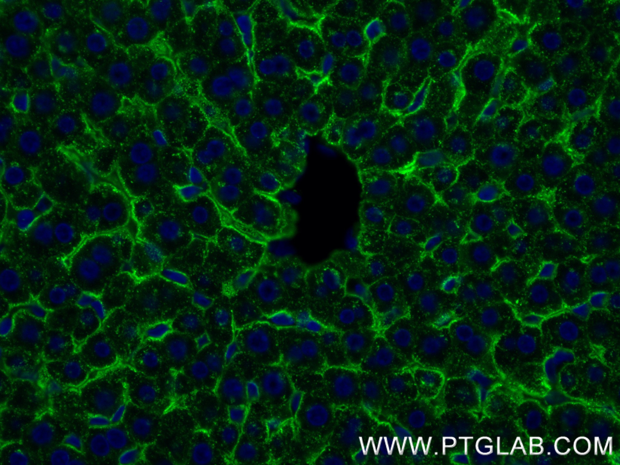 Immunofluorescence (IF) / fluorescent staining of rat liver tissue using ASGR1 Recombinant antibody (83691-3-RR)