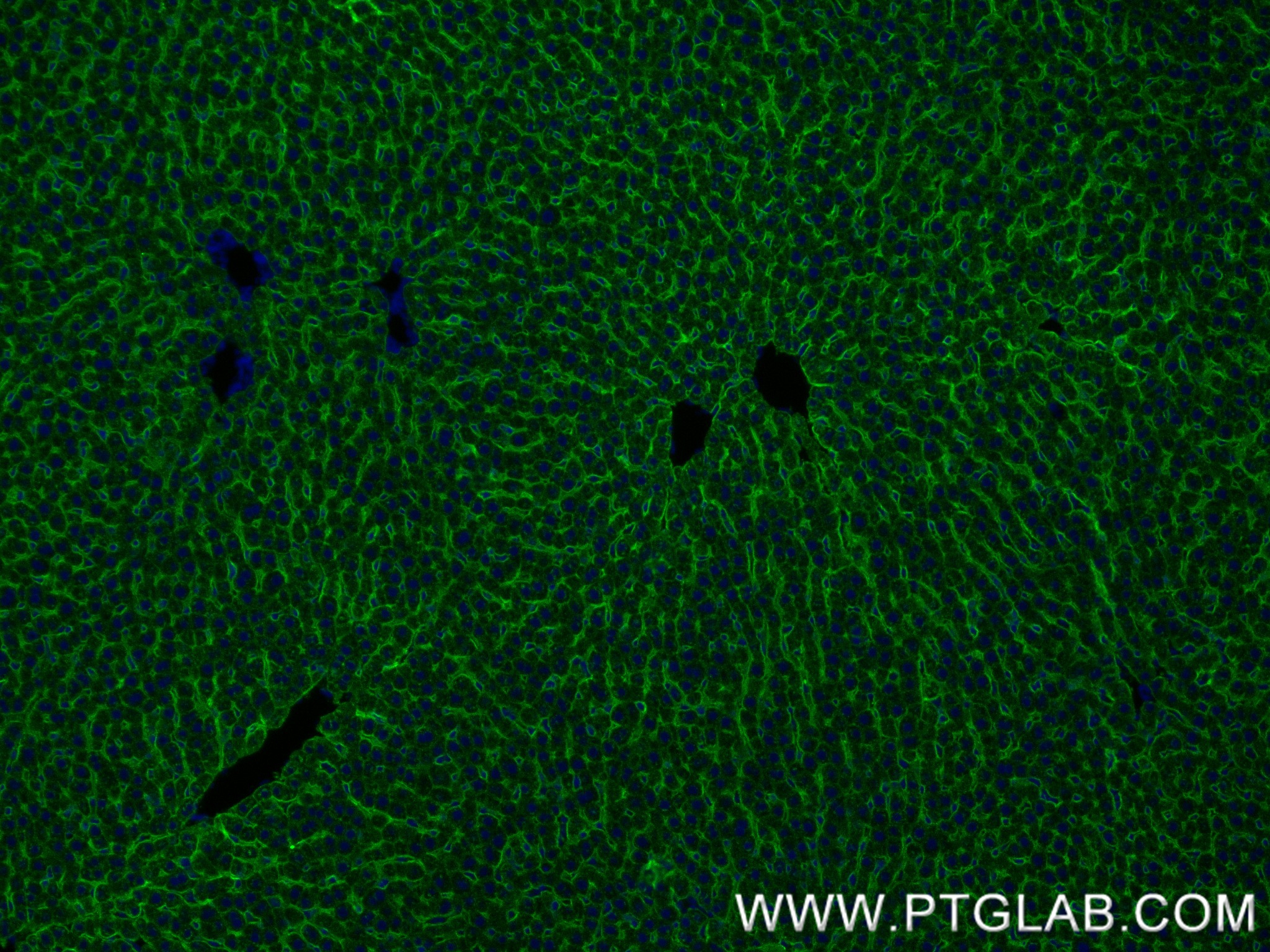 Immunofluorescence (IF) / fluorescent staining of rat liver tissue using ASGR1 Recombinant antibody (83691-3-RR)