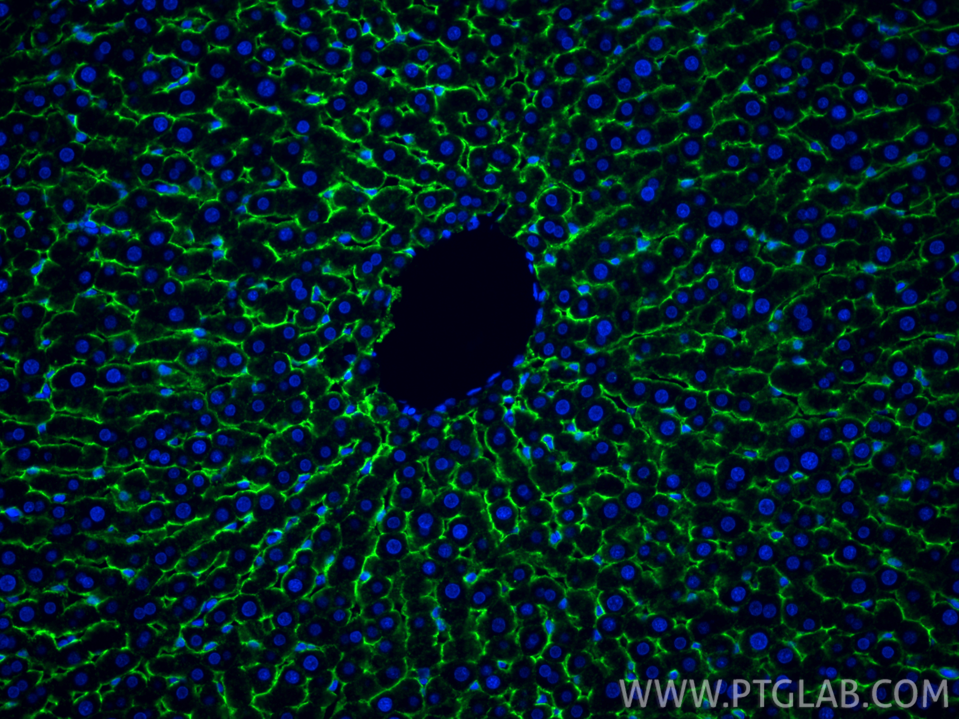 Immunofluorescence (IF) / fluorescent staining of rat liver tissue using ASGR1 Recombinant antibody (83691-3-RR)