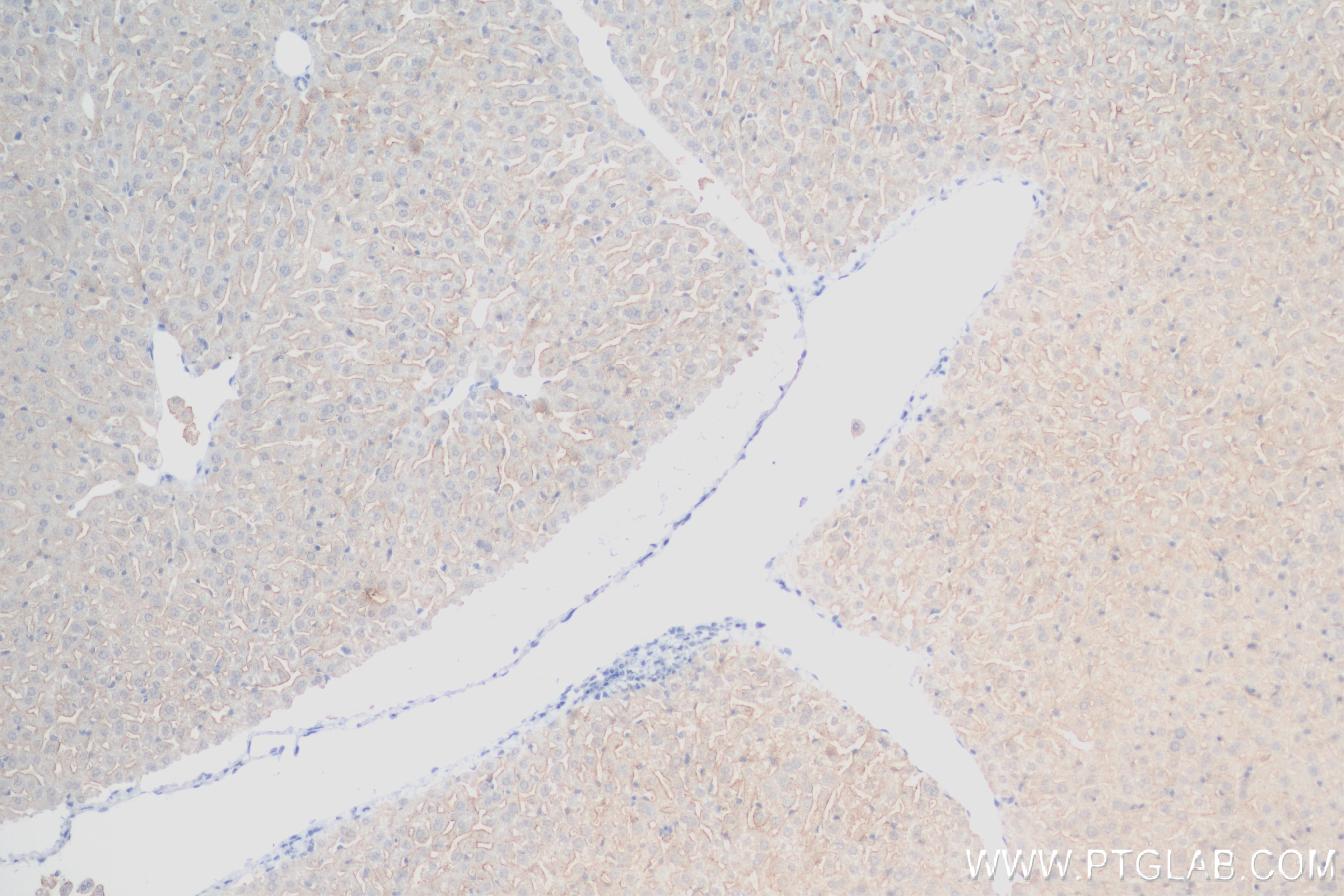 Immunohistochemistry (IHC) staining of mouse liver tissue using ASGR1 Recombinant antibody (83691-3-RR)