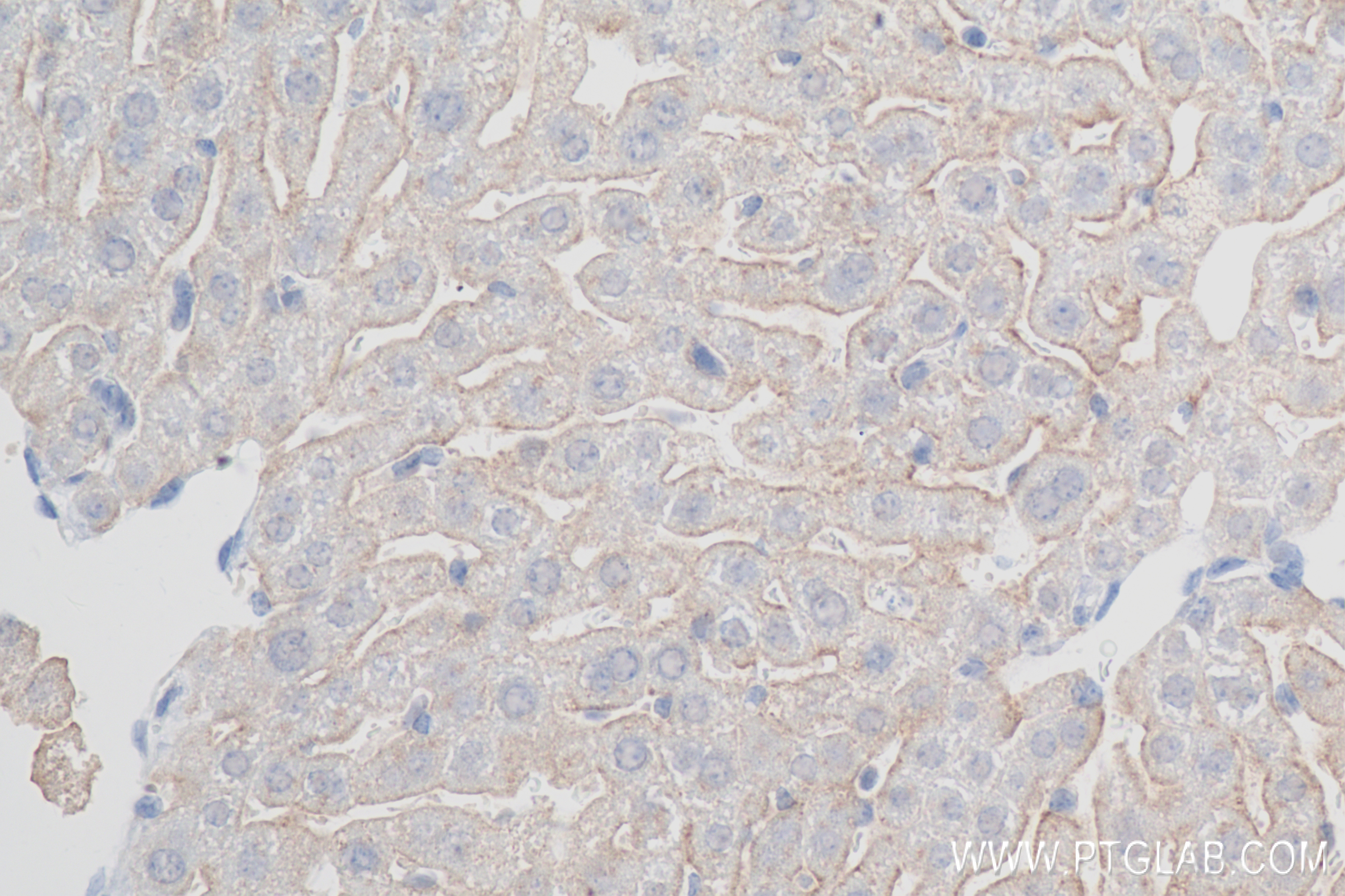 Immunohistochemistry (IHC) staining of mouse liver tissue using ASGR1 Recombinant antibody (83691-3-RR)