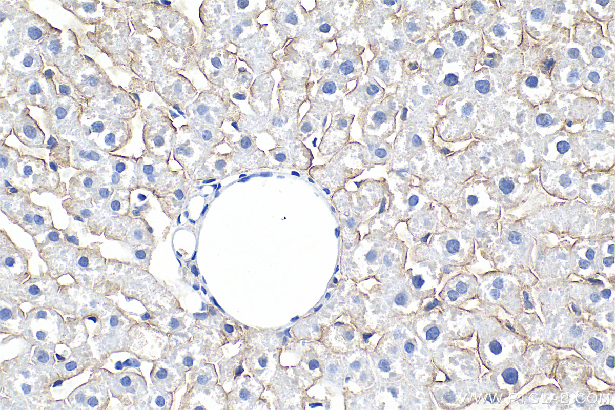Immunohistochemistry (IHC) staining of rat liver tissue using Biotin-conjugated ASGR1 Polyclonal antibody (Biotin-11739)