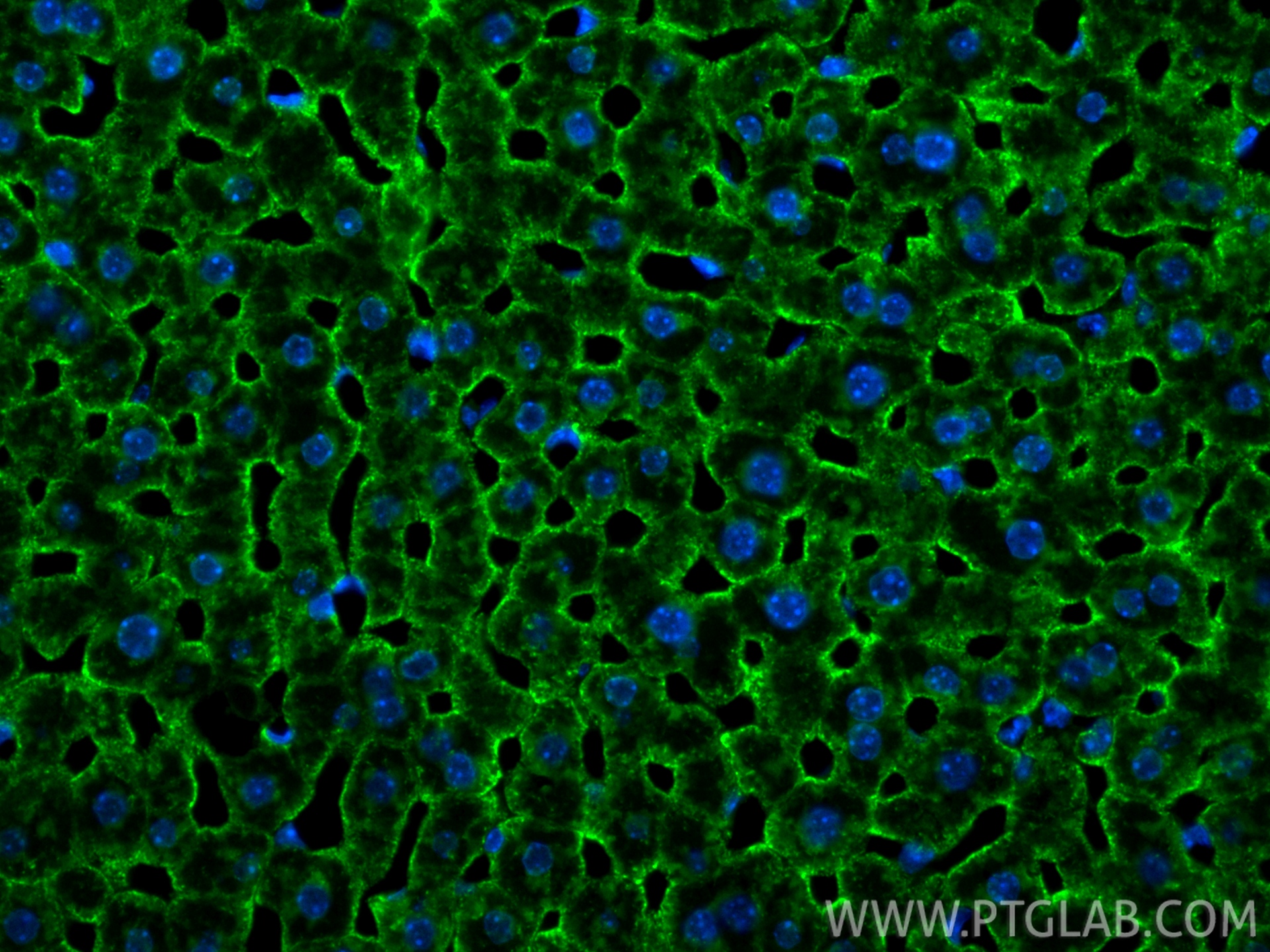 Immunofluorescence (IF) / fluorescent staining of mouse liver tissue using CoraLite® Plus 488-conjugated ASGR1 Polyclonal ant (CL488-11739)
