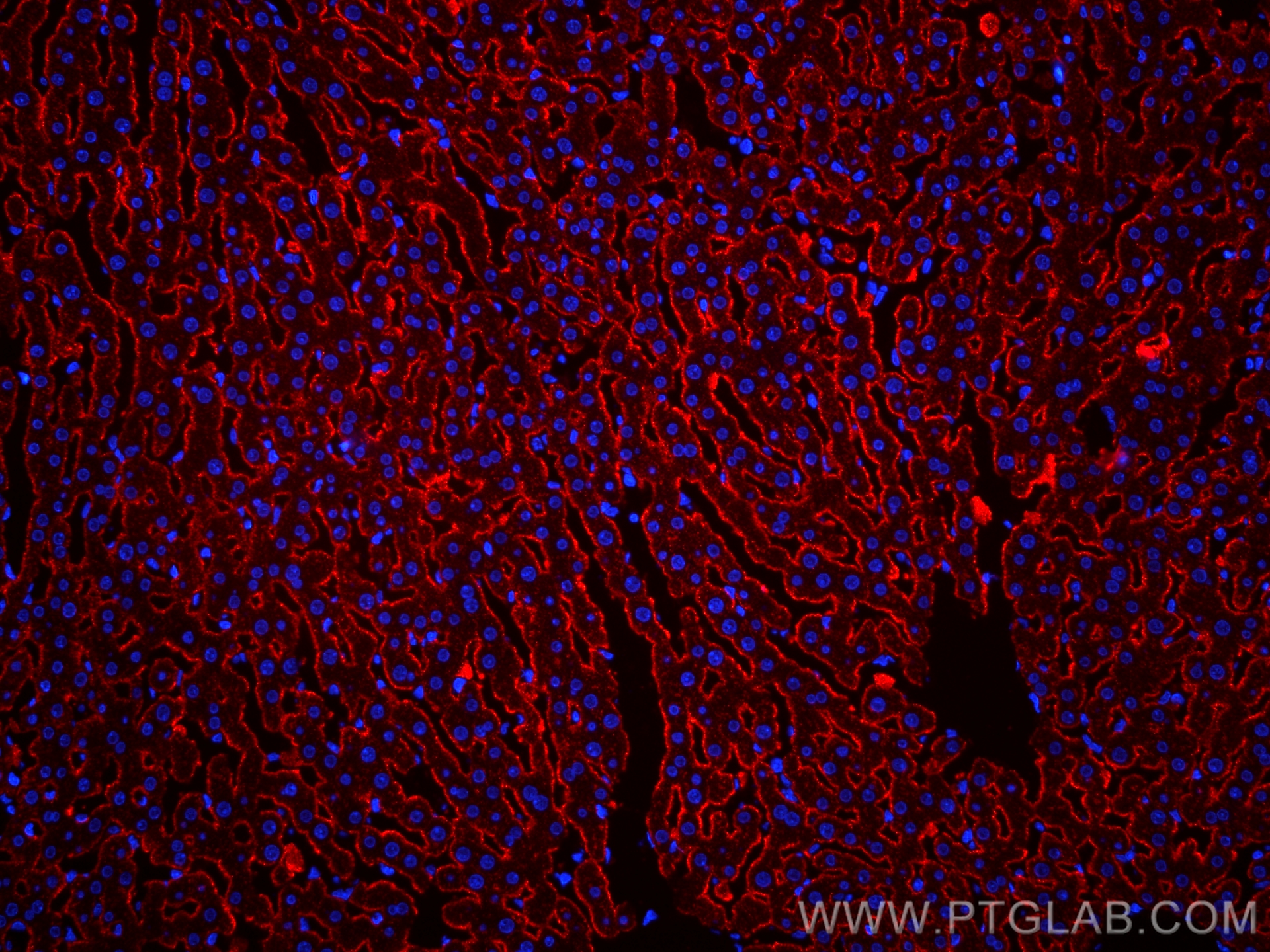 Immunofluorescence (IF) / fluorescent staining of rat liver tissue using CoraLite®594-conjugated ASGR1 Polyclonal antibody (CL594-11739)