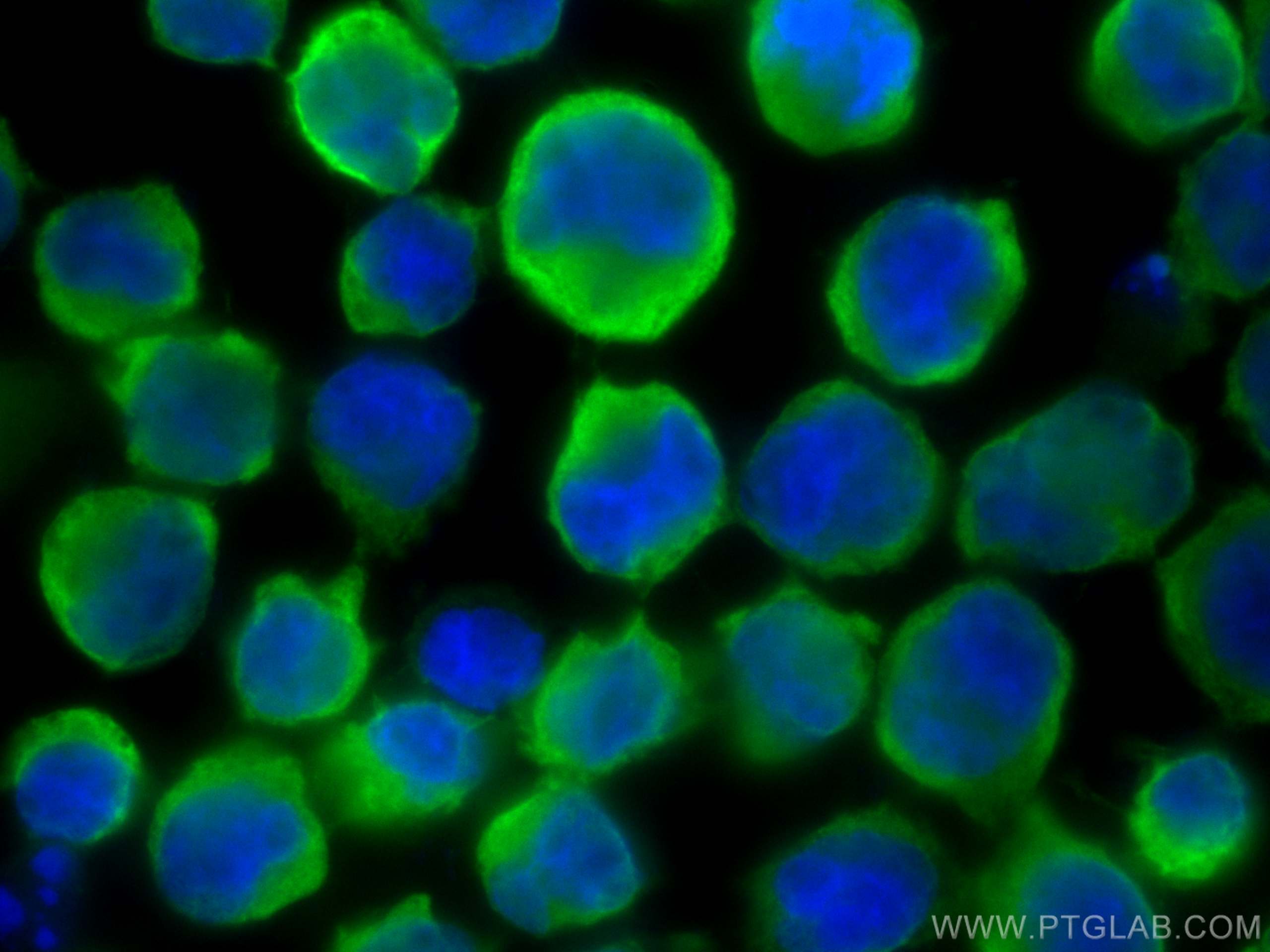 Immunofluorescence (IF) / fluorescent staining of K-562 cells using ASNS Polyclonal antibody (14681-1-AP)