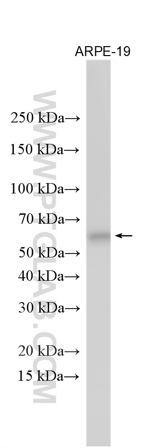 Western Blot (WB) analysis of various lysates using ASNS Polyclonal antibody (14681-1-AP)