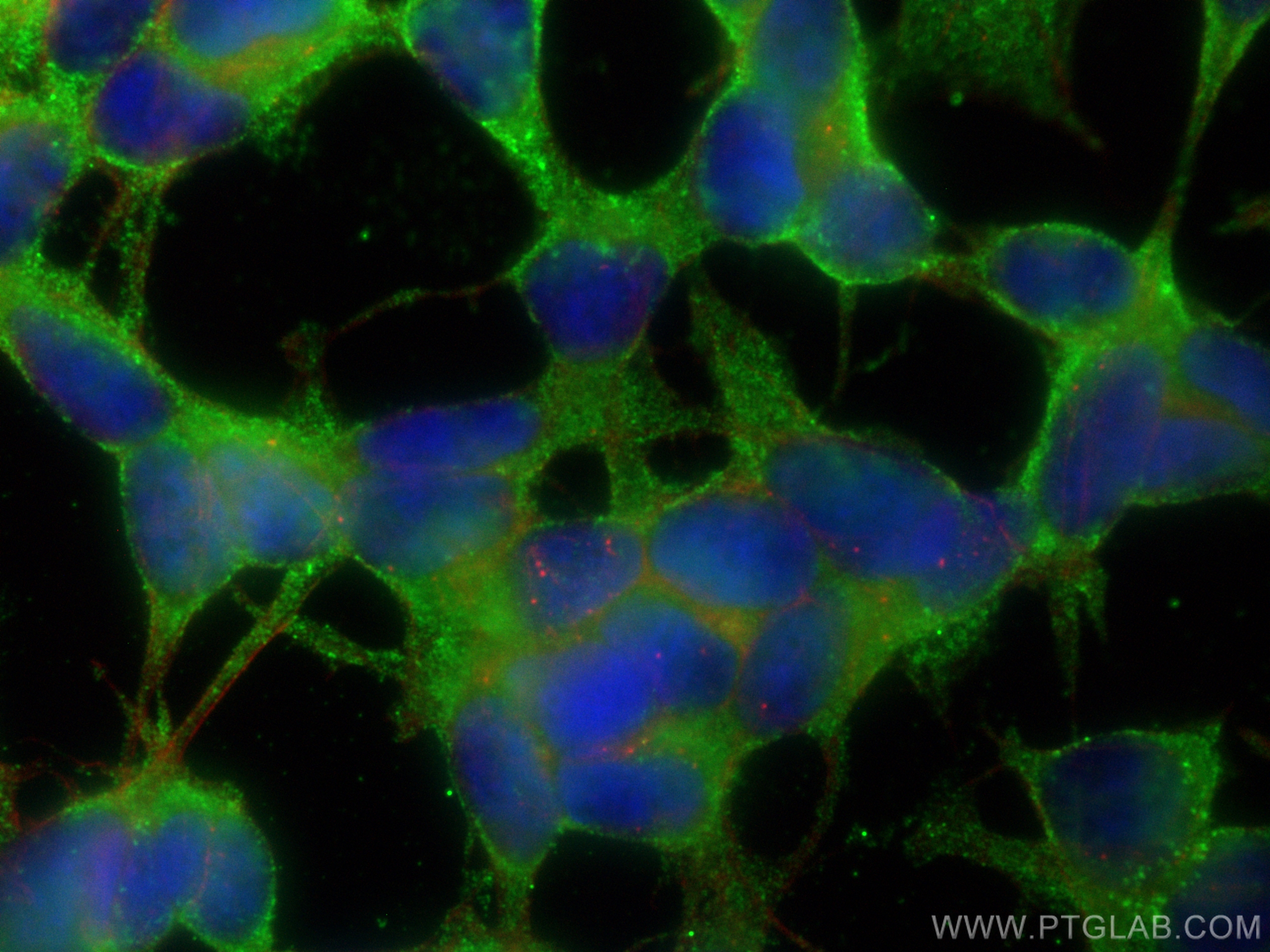 Immunofluorescence (IF) / fluorescent staining of SH-SY5Y cells using ASNS Monoclonal antibody (68004-1-Ig)