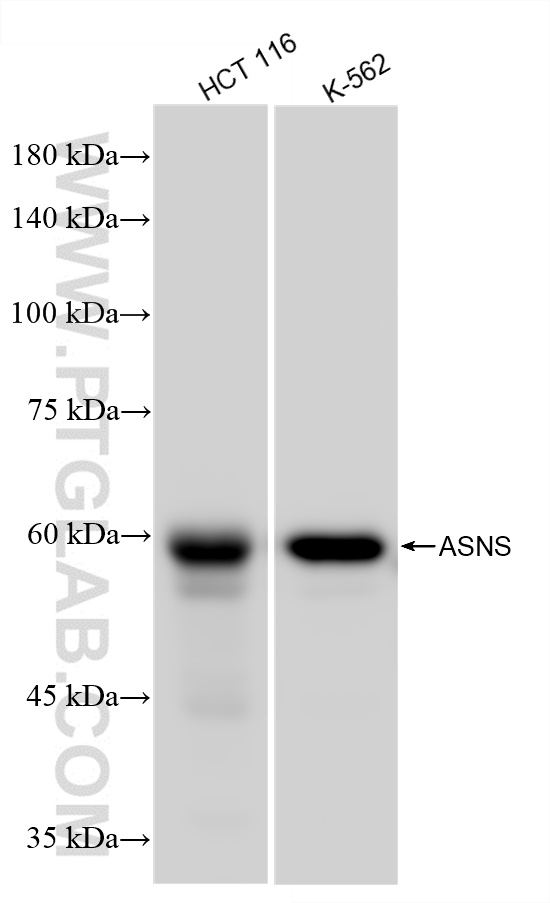 Western Blot (WB) analysis of various lysates using ASNS Recombinant antibody (85892-1-RR)
