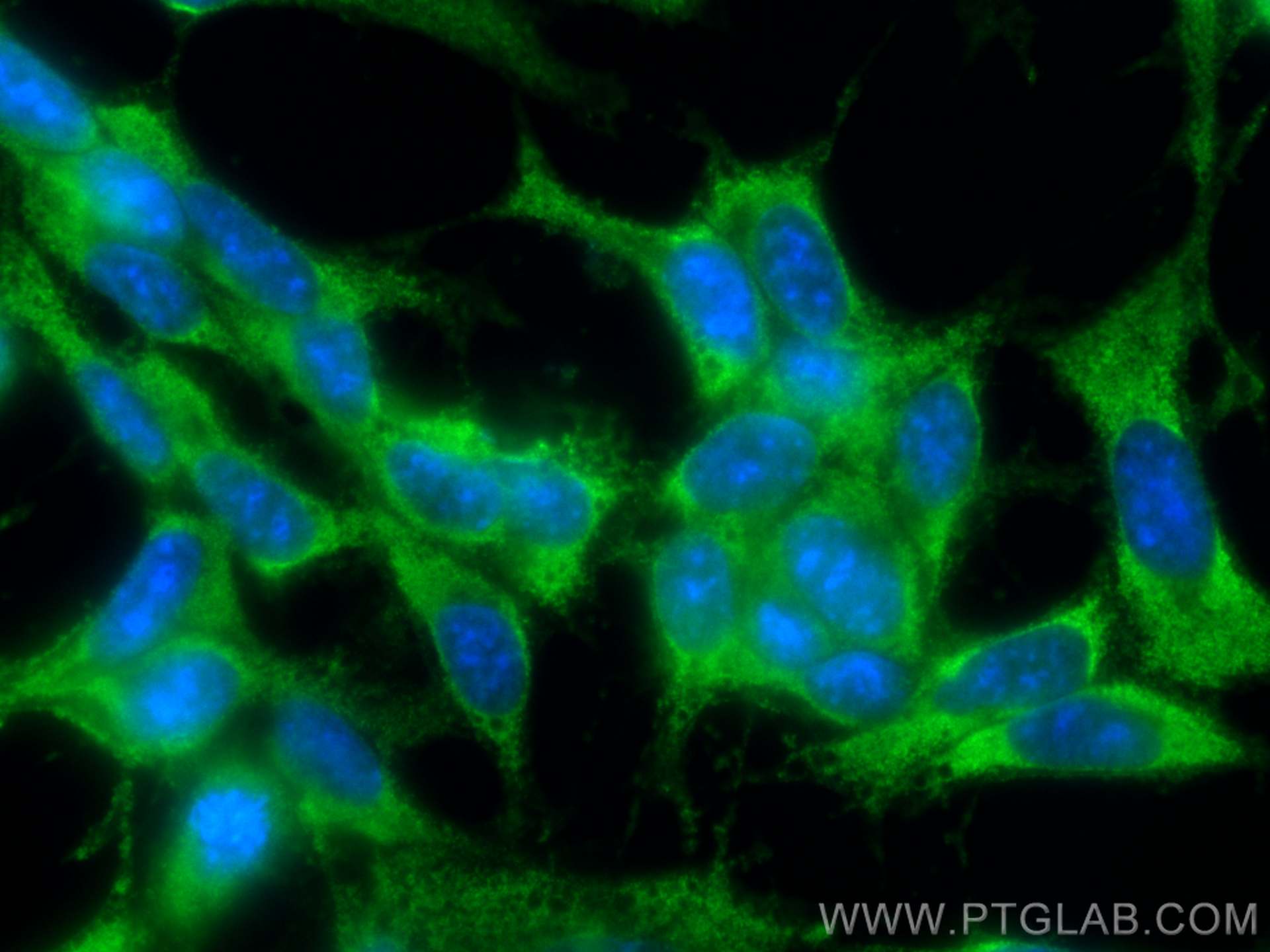 Immunofluorescence (IF) / fluorescent staining of SH-SY5Y cells using CoraLite® Plus 488-conjugated ASNS Monoclonal anti (CL488-68004)