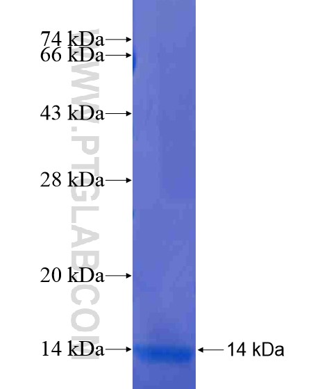 ASPHD1 fusion protein Ag20954 SDS-PAGE