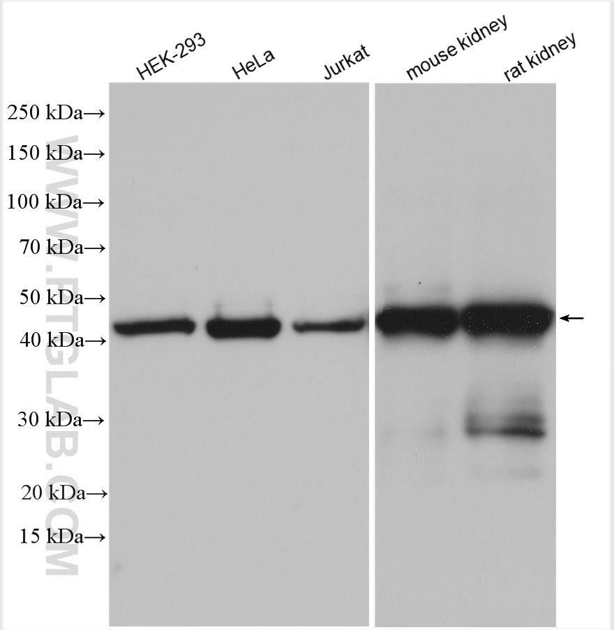 Western Blot (WB) analysis of various lysates using ASS1 Polyclonal antibody (16210-1-AP)