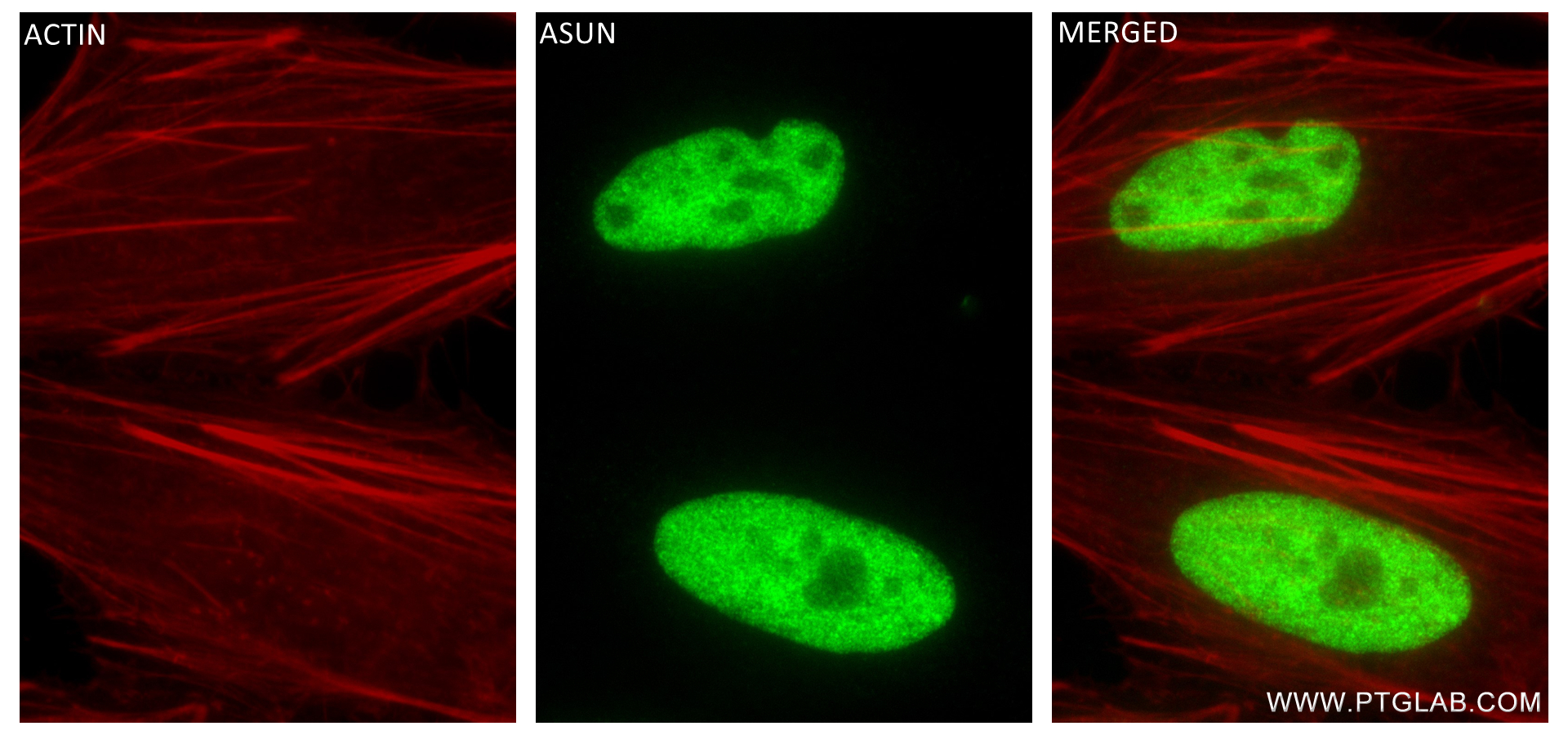 Immunofluorescence (IF) / fluorescent staining of HeLa cells using ASUN Recombinant antibody (84252-4-RR)