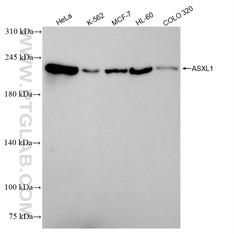 Western Blot (WB) analysis of various lysates using ASXL1 Recombinant antibody (84630-1-RR)