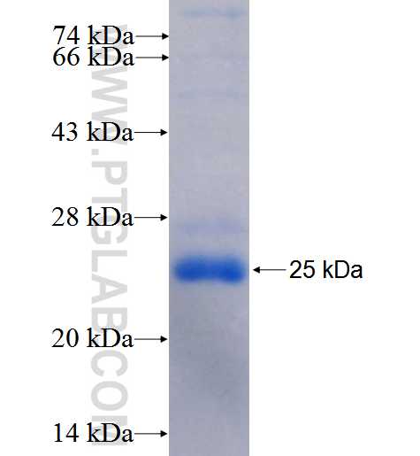 ASXL2 fusion protein Ag24402 SDS-PAGE