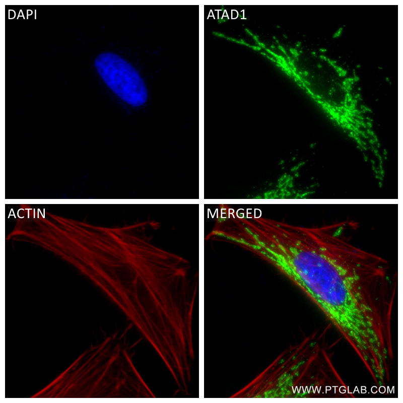 Immunofluorescence (IF) / fluorescent staining of HeLa cells using ATAD1 Recombinant antibody (84194-6-RR)