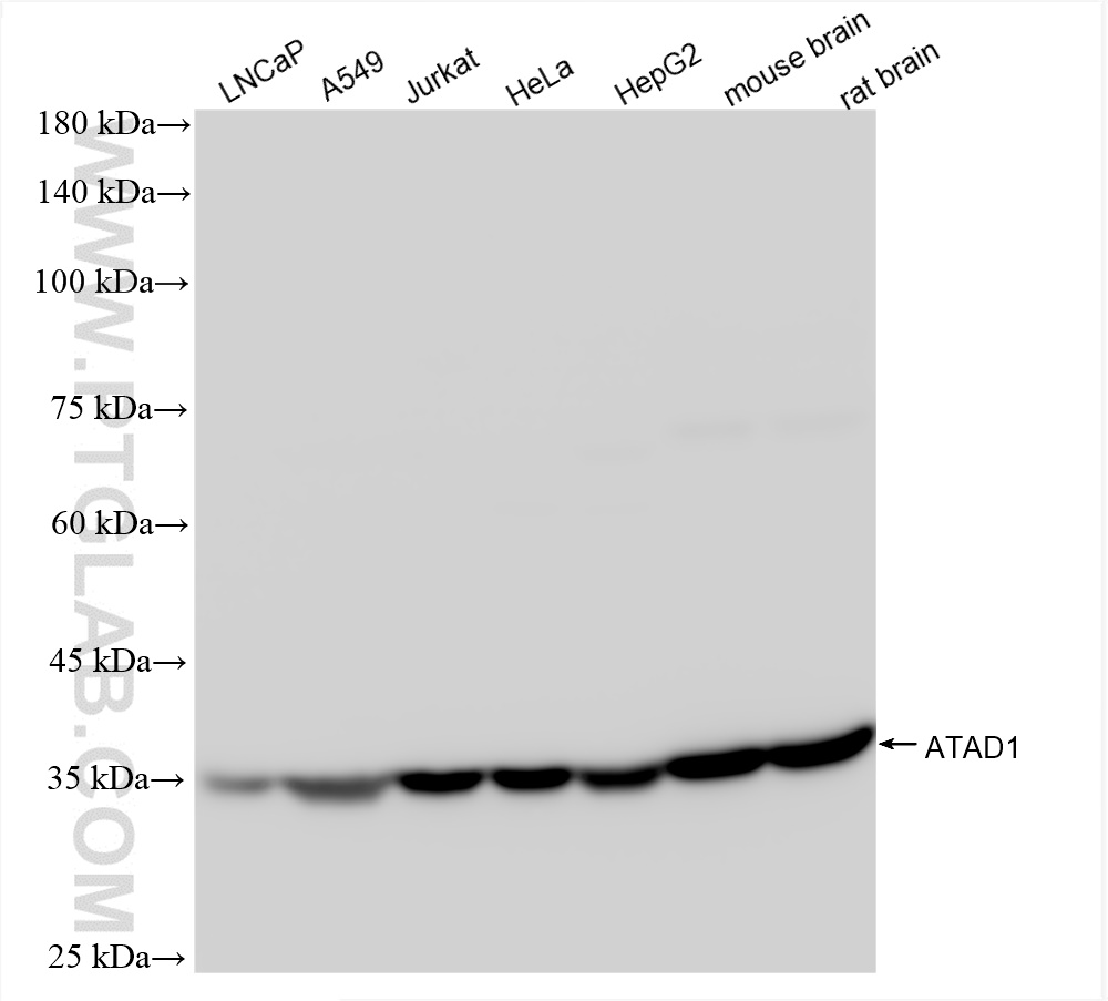 Western Blot (WB) analysis of various lysates using ATAD1 Recombinant antibody (84194-6-RR)