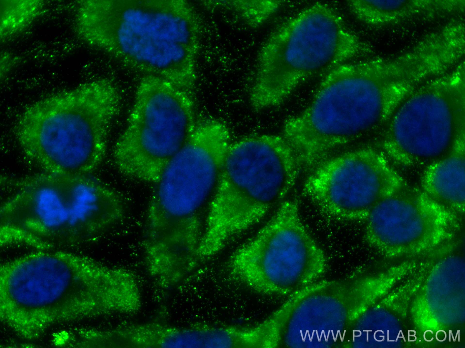 Immunofluorescence (IF) / fluorescent staining of A431 cells using ATAD4 / PRR15L Polyclonal antibody (25693-1-AP)