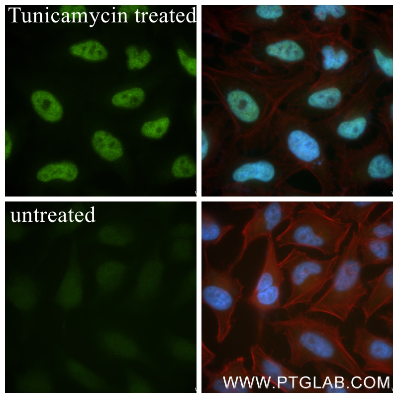 Immunofluorescence (IF) / fluorescent staining of HeLa cells using ATF4 Recombinant antibody (81798-2-RR)