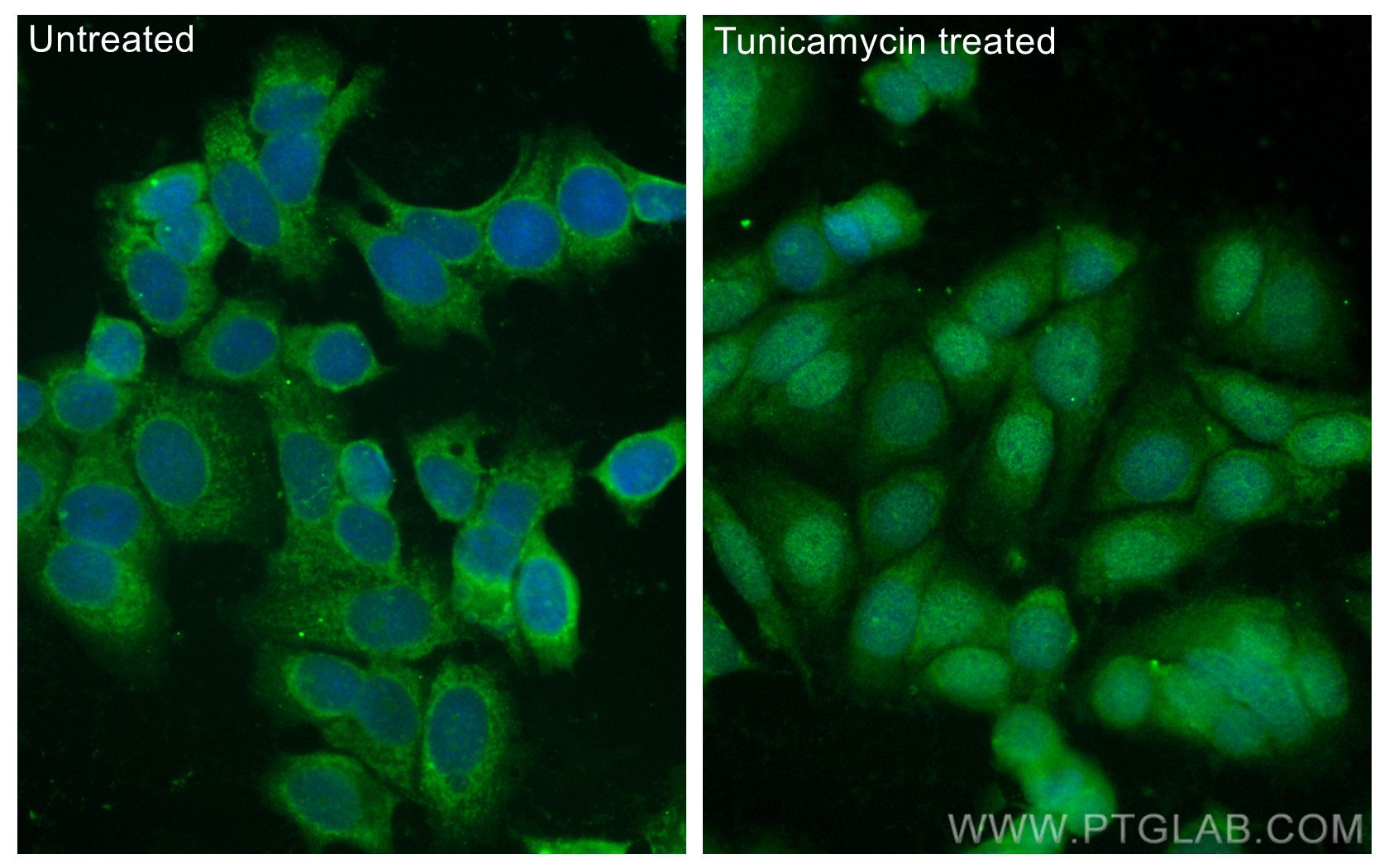 Immunofluorescence (IF) / fluorescent staining of MCF-7 cells using CoraLite® Plus 488-conjugated ATF4 Polyclonal anti (CL488-10835)