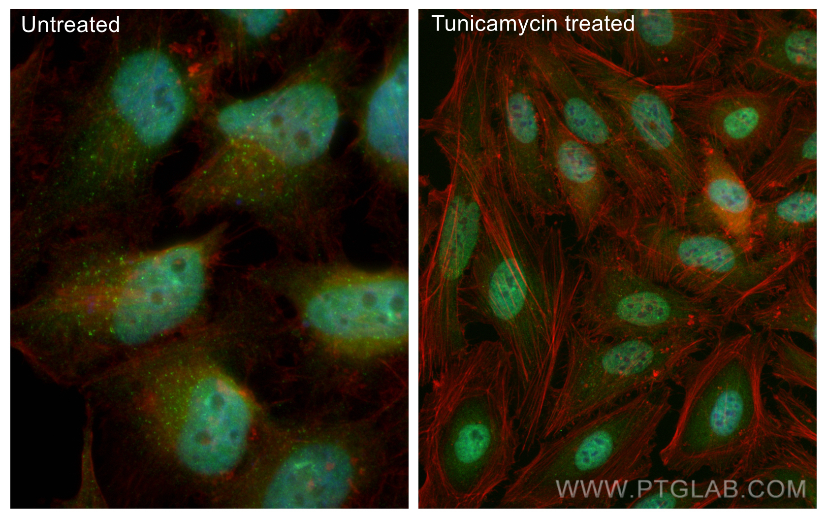 Immunofluorescence (IF) / fluorescent staining of HeLa cells using CoraLite® Plus 488-conjugated ATF4 Recombinant ant (CL488-81798-2)