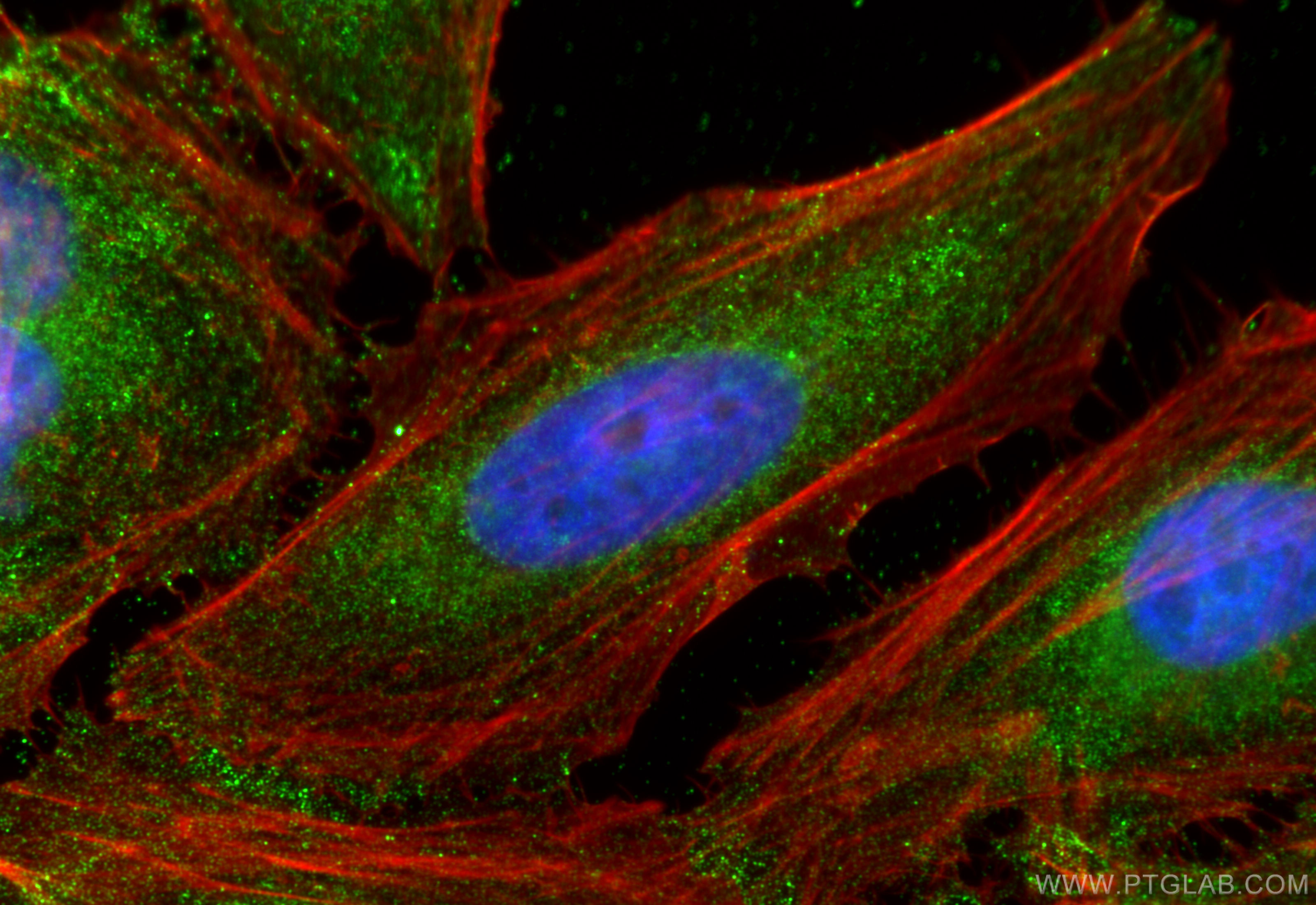 Immunofluorescence (IF) / fluorescent staining of HeLa cells using ATF6 Monoclonal antibody (66563-1-Ig)