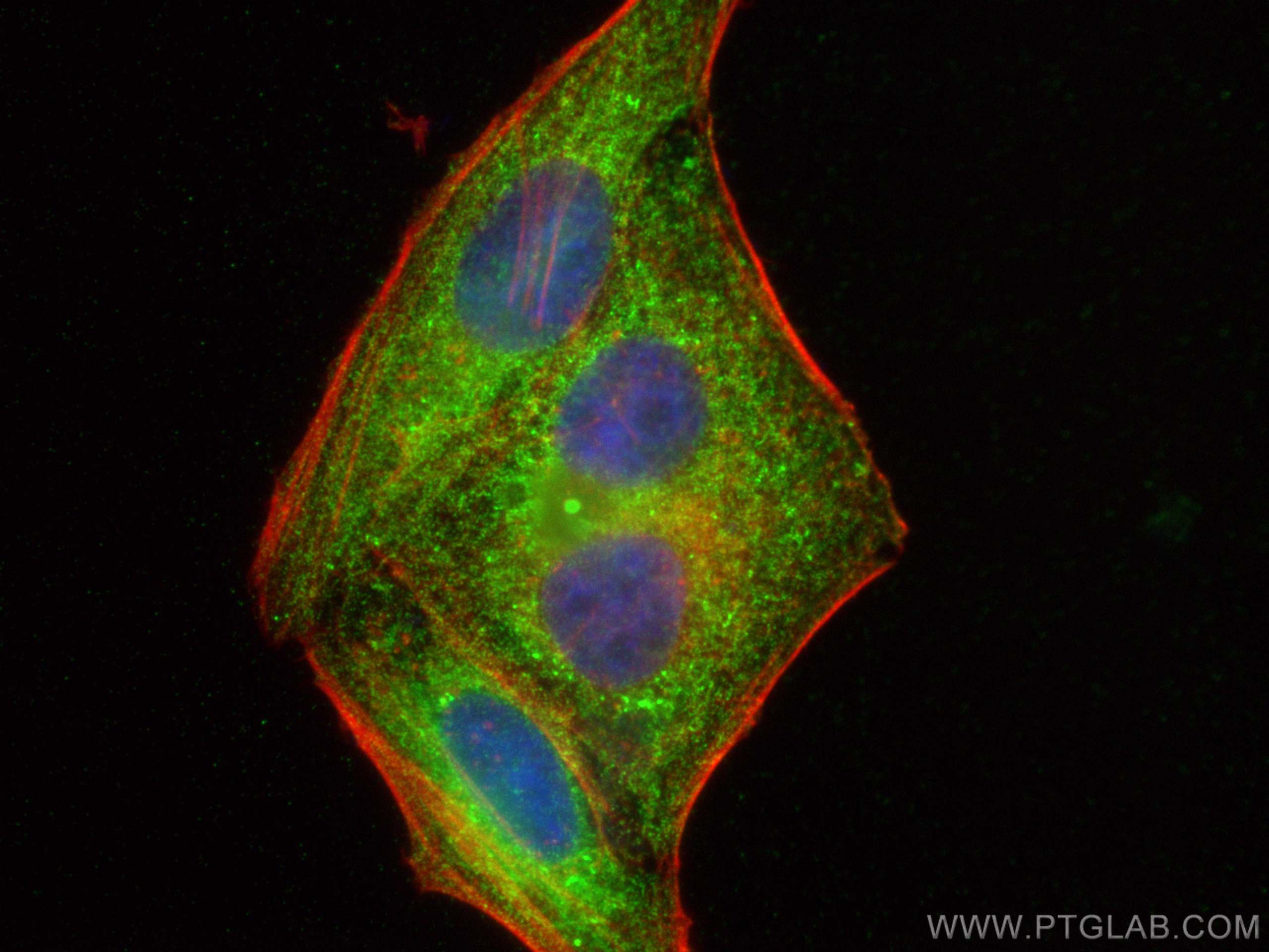 Immunofluorescence (IF) / fluorescent staining of HepG2 cells using CoraLite® Plus 488-conjugated ATF6 Monoclonal anti (CL488-66563)