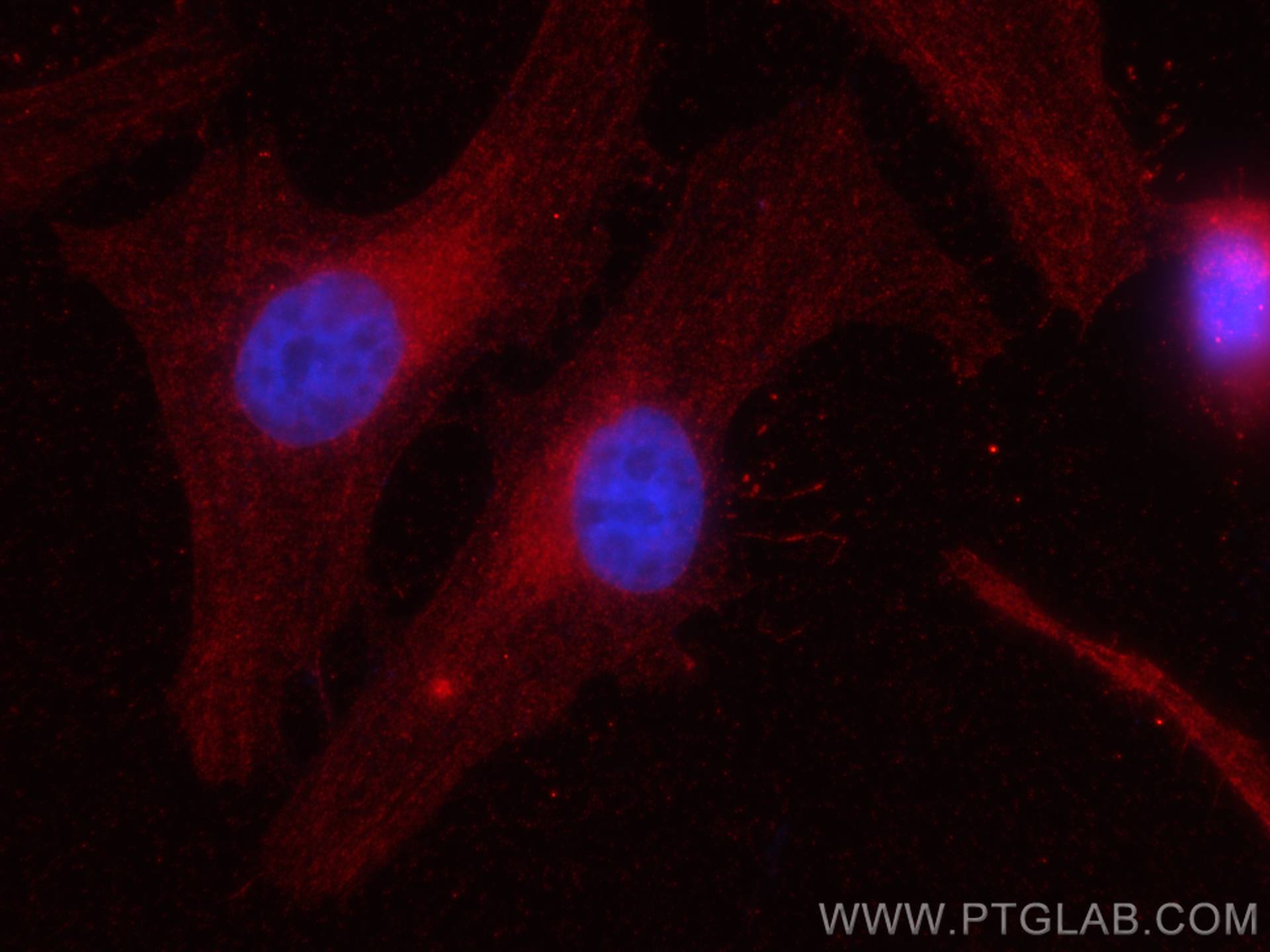 Immunofluorescence (IF) / fluorescent staining of HeLa cells using CoraLite®594-conjugated ATF6 Monoclonal antibody (CL594-66563)