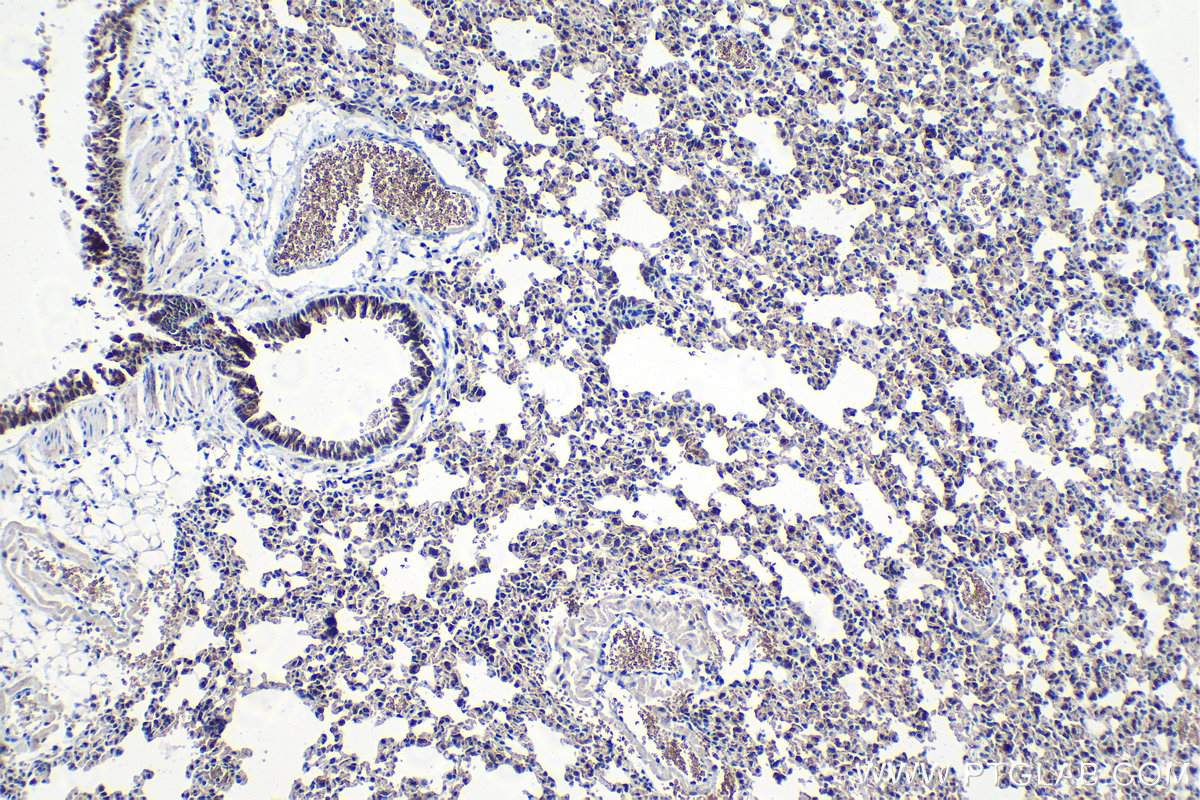 Immunohistochemistry (IHC) staining of mouse lung tissue using ATF7 Polyclonal antibody (29770-1-AP)