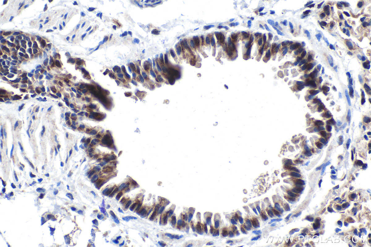 Immunohistochemistry (IHC) staining of mouse lung tissue using ATF7 Polyclonal antibody (29770-1-AP)