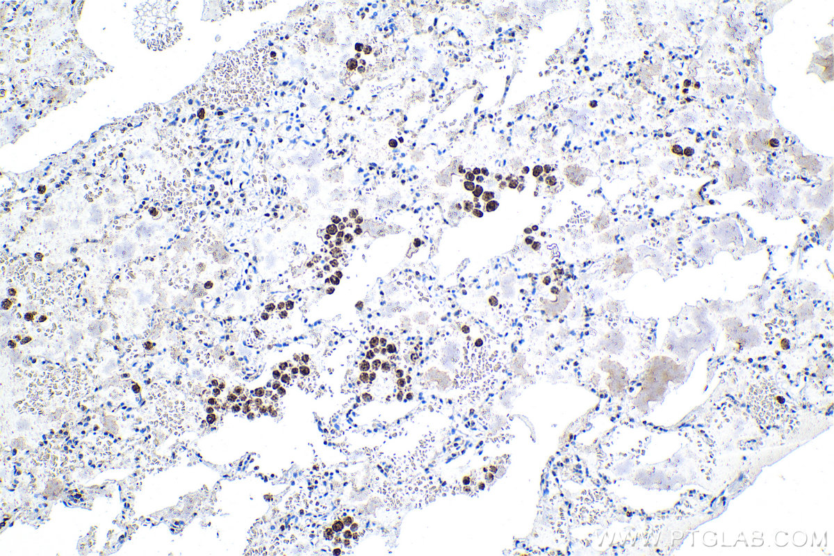 Immunohistochemistry (IHC) staining of human lung tissue using ATF7 Polyclonal antibody (29770-1-AP)