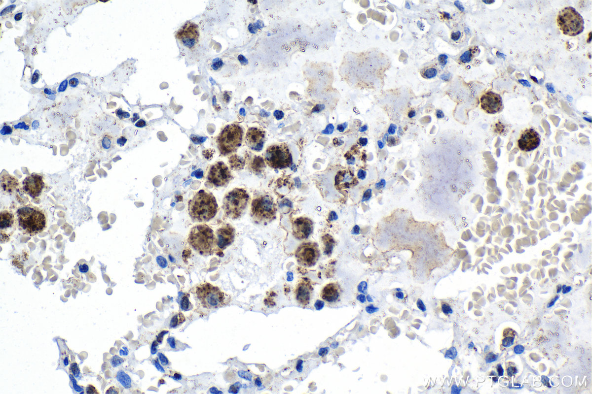 Immunohistochemistry (IHC) staining of human lung tissue using ATF7 Polyclonal antibody (29770-1-AP)