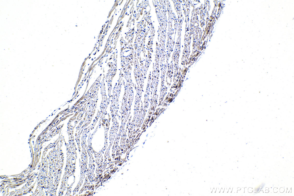 Immunohistochemistry (IHC) staining of mouse heart tissue using ATF7 Polyclonal antibody (29770-1-AP)