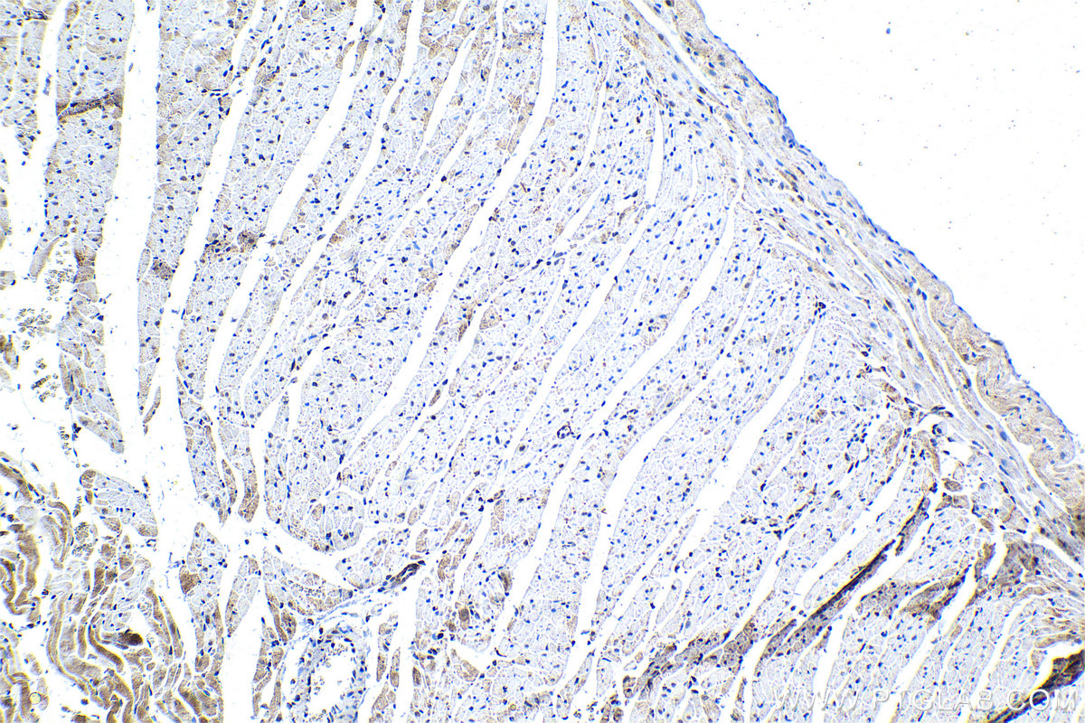 Immunohistochemistry (IHC) staining of rat heart tissue using ATF7 Polyclonal antibody (29770-1-AP)