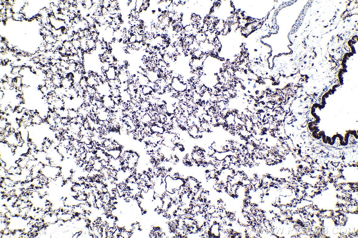 Immunohistochemistry (IHC) staining of rat lung tissue using ATF7 Polyclonal antibody (29770-1-AP)